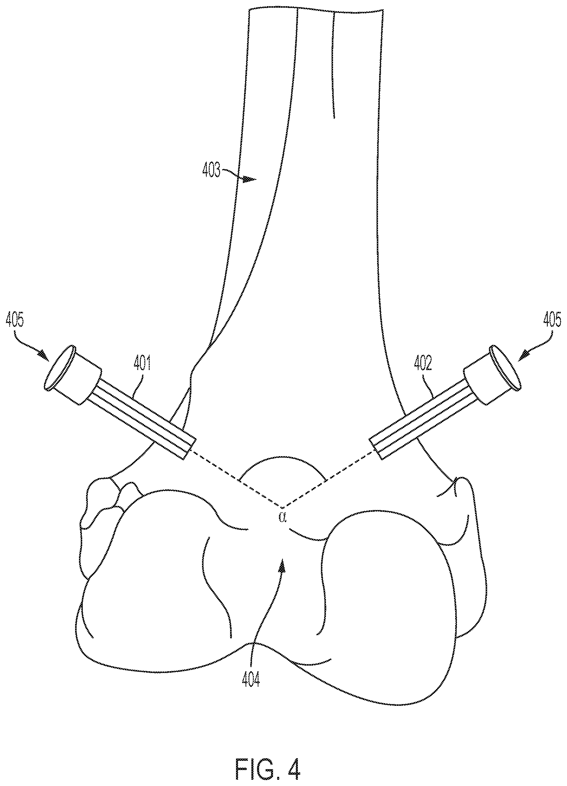 Patent US12496043 Figure 4 – Methods for improved ultrasound imaging to emphasize structures of interest and devices thereof
