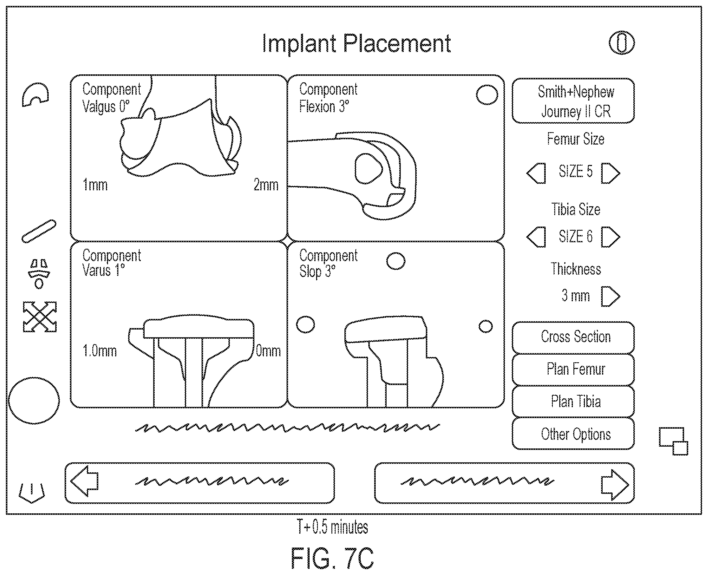 Patent US12496043 Figure 11 – Methods for improved ultrasound imaging to emphasize structures of interest and devices thereof