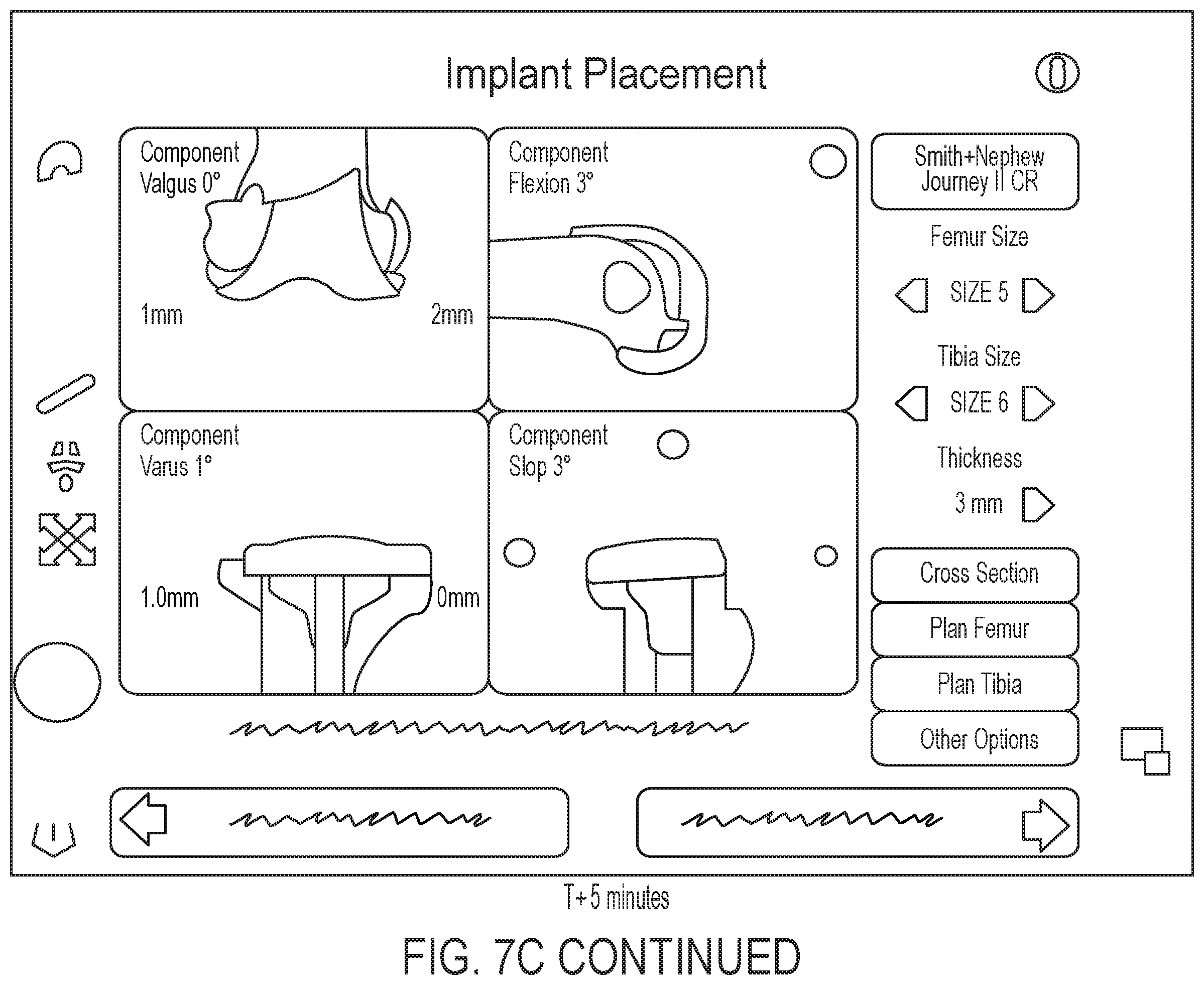 Patent US12496043 Figure 13 – Methods for improved ultrasound imaging to emphasize structures of interest and devices thereof