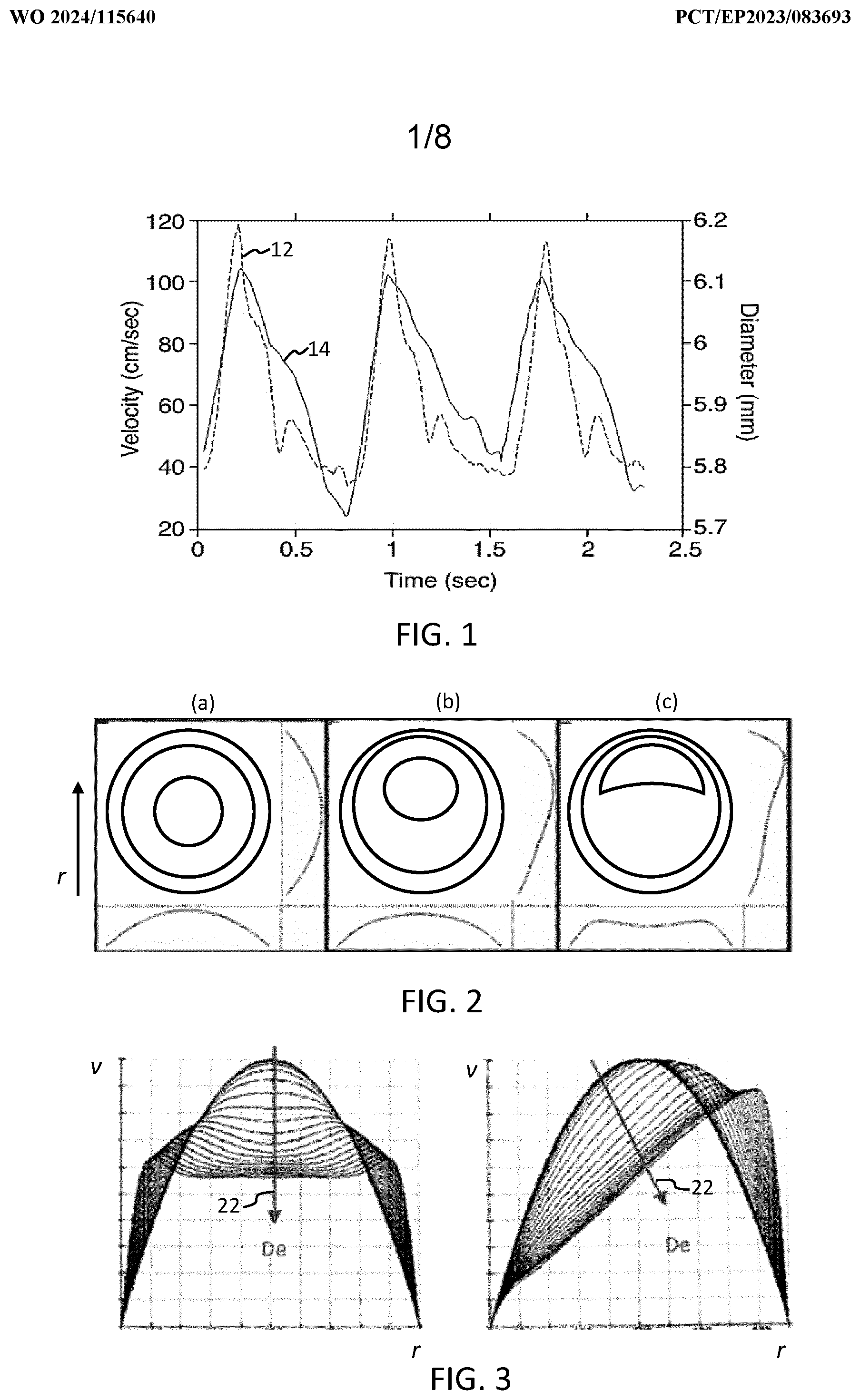 Patent US12496046 — Hemodynamic parameter estimation — Figure 1