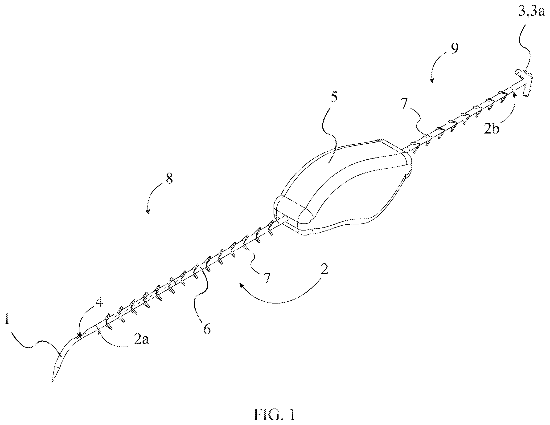 Patent US12496054 Figure 1 – Intracorporeal retracting suture