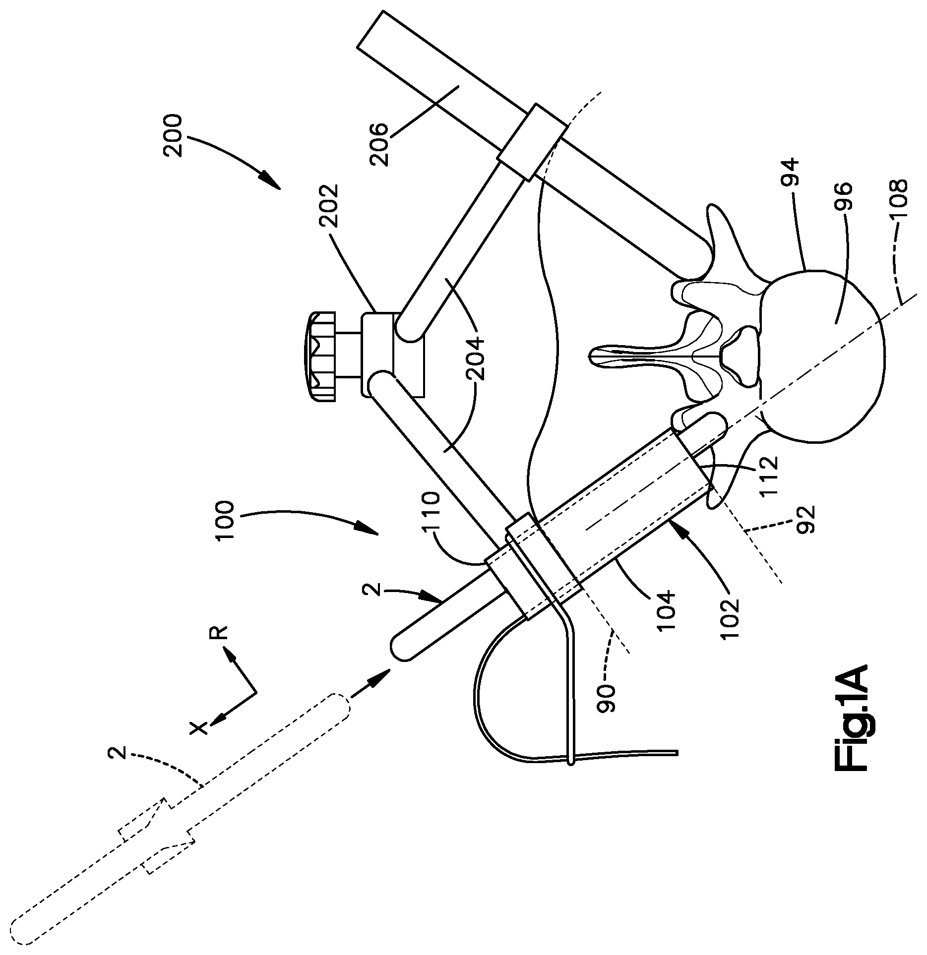 Patent US12496055 — Retractor members, and related systems and methods — Figure 1