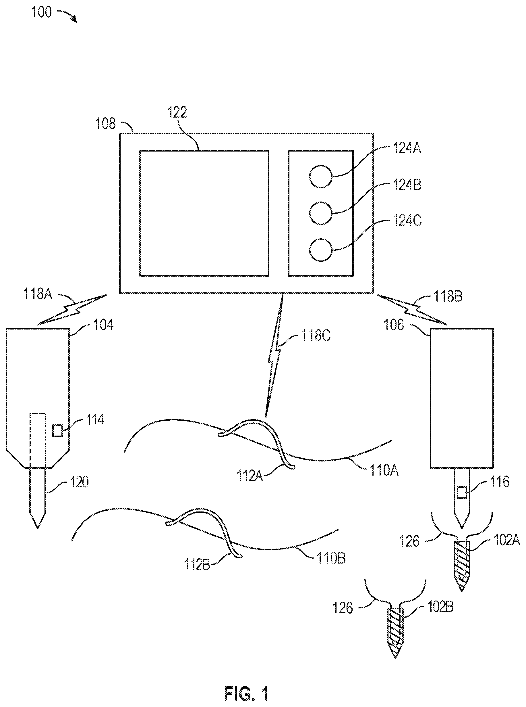 Patent US12496058 — Sensor-based arthroscopic anchor system — Figure 1