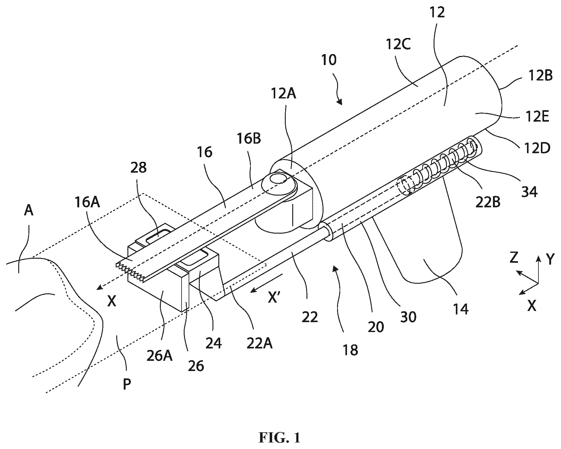 Patent US12496070 — Retractable cutting guide — Figure 1