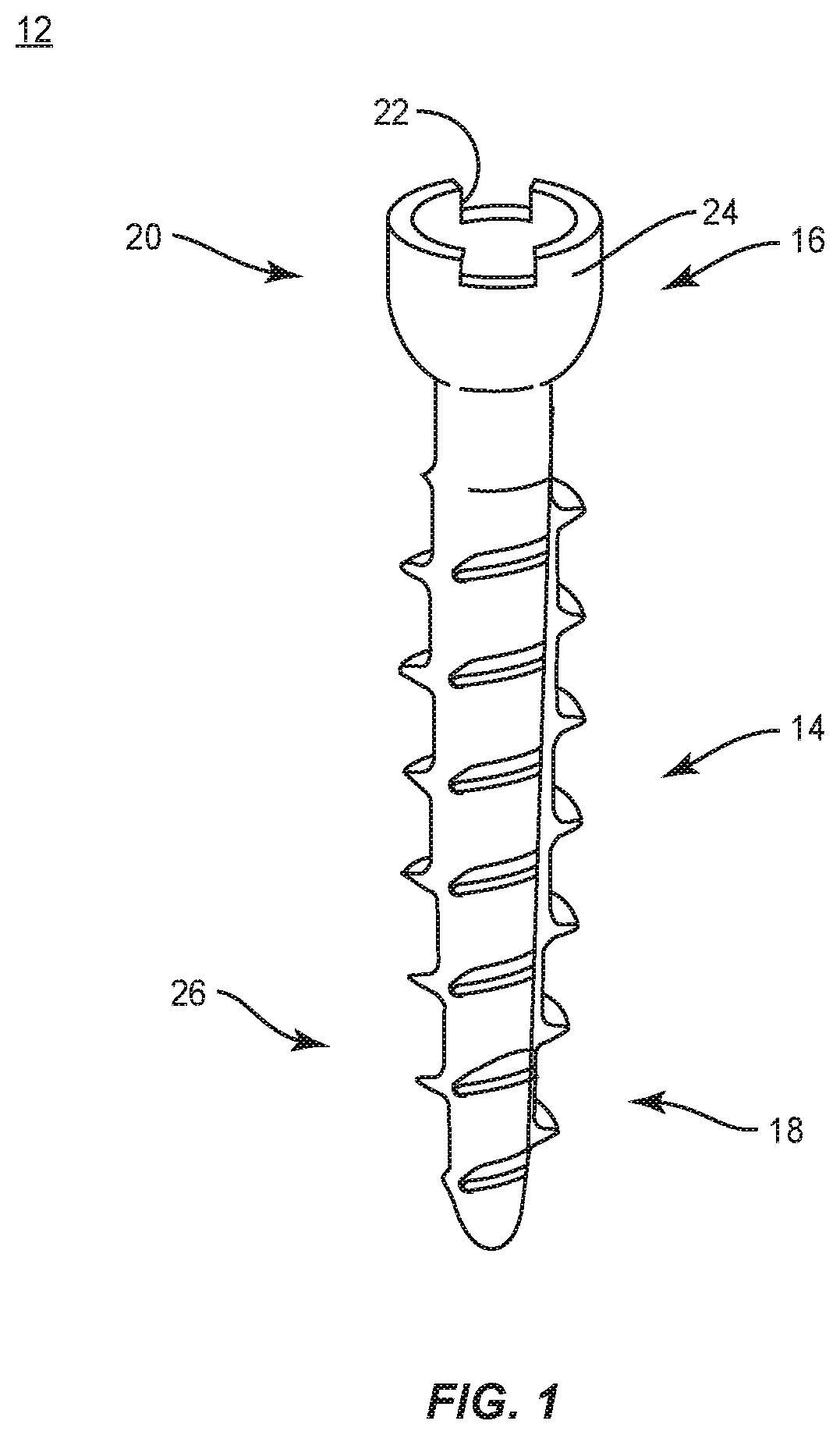 Patent US12496073 Figure 1 – Surgical implant system and methods of use