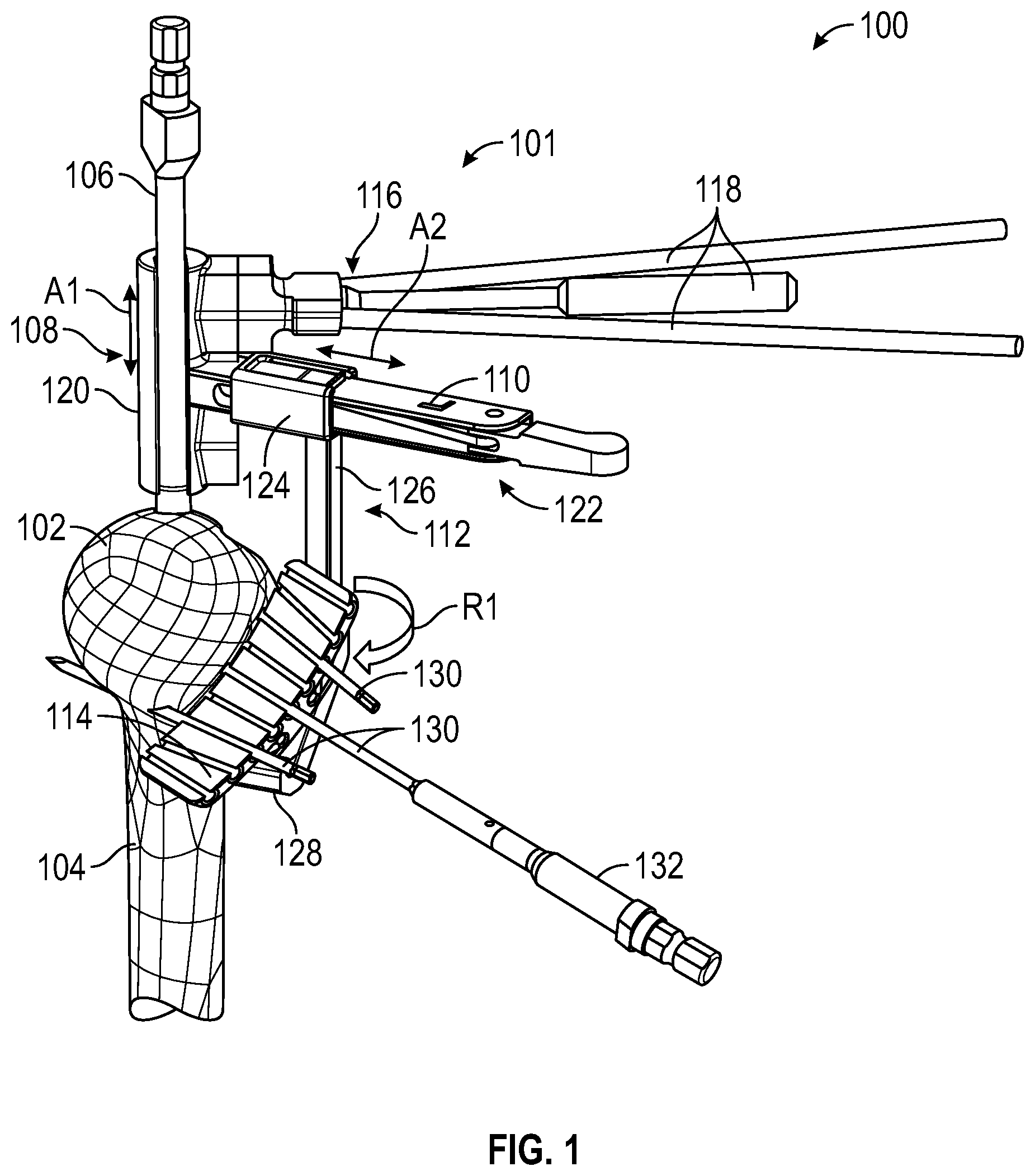 Patent US12496074 — Instruments and systems including a humeral cut guide assembly for an orthopedic shoulder replacement — Figure 1