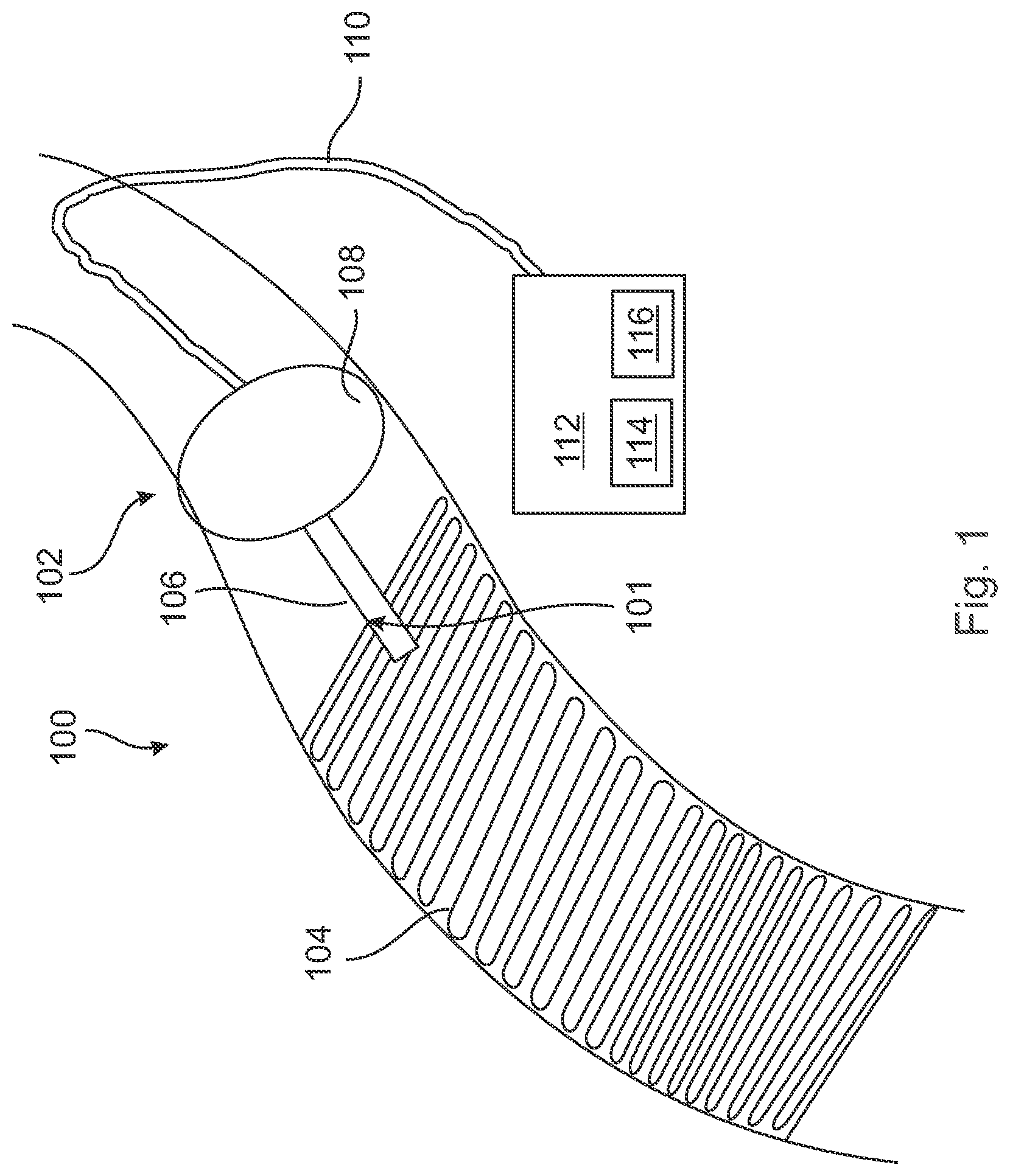 Patent US12496089 — Vessel blockage passing — Figure 1