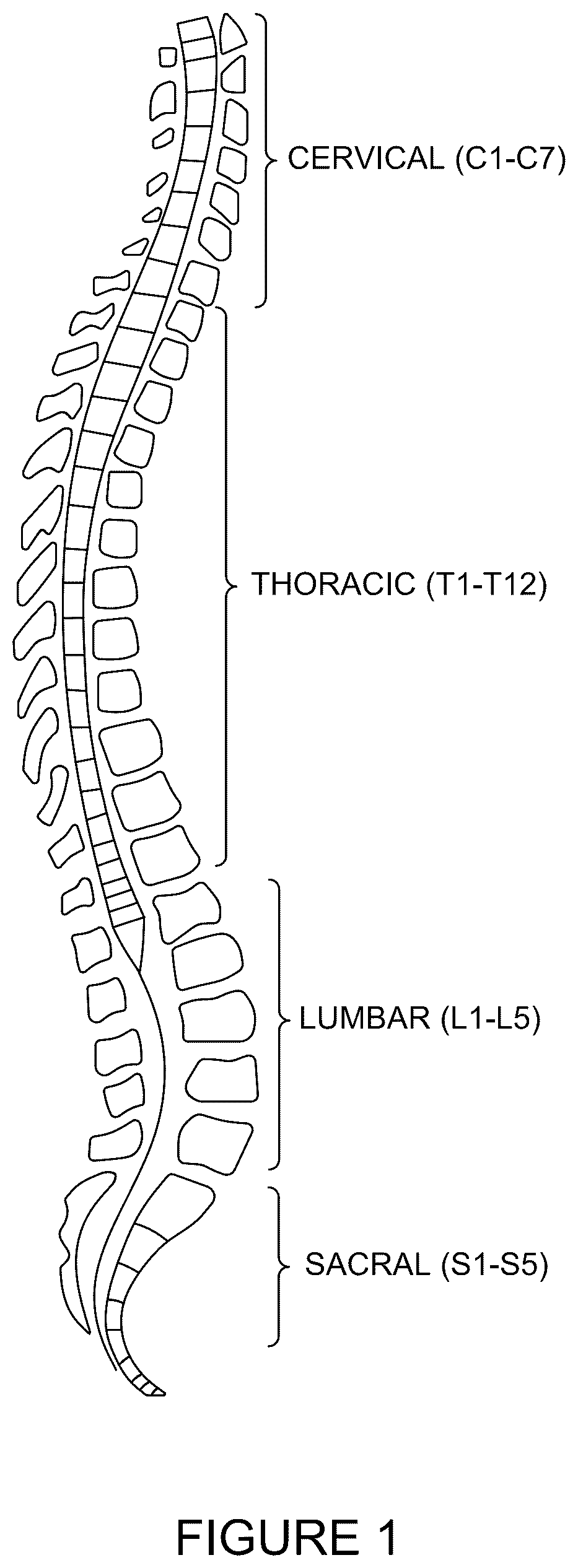 Patent US12496094 — Methods of detecting and treating back pain — Figure 1