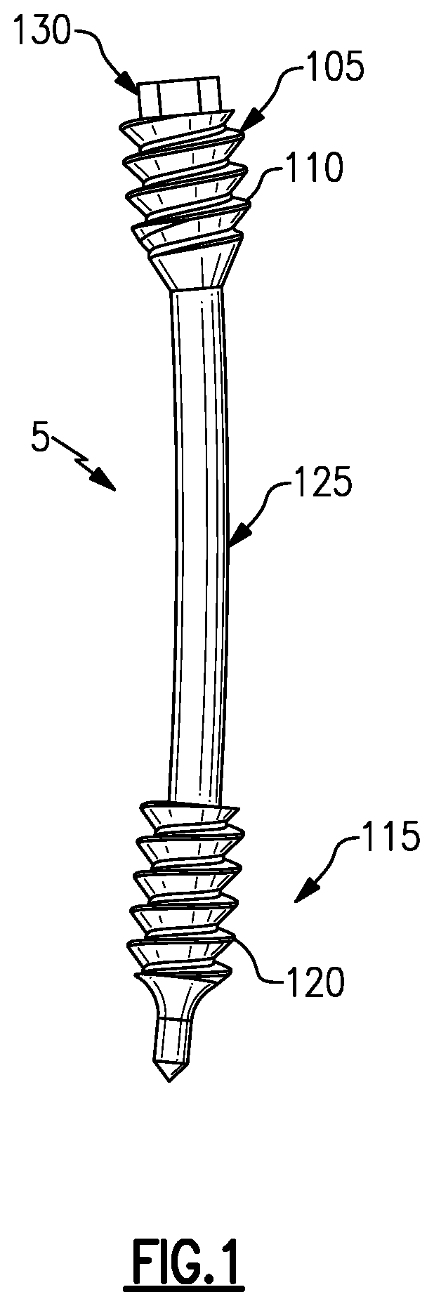 Patent US12496105 — Devices for generating and applying compression within a body — Figure 1