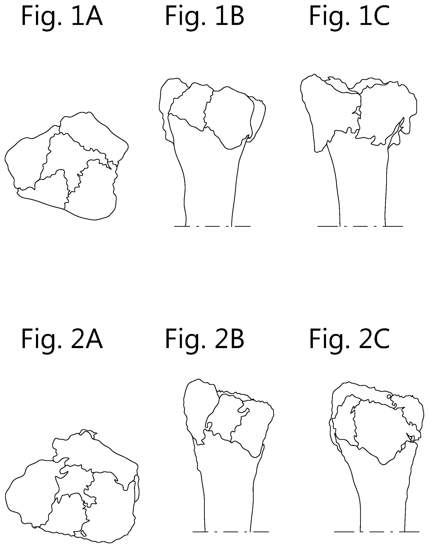 Patent US12496109 Figure 1 – Implantable plate and method of manufacturing thereof