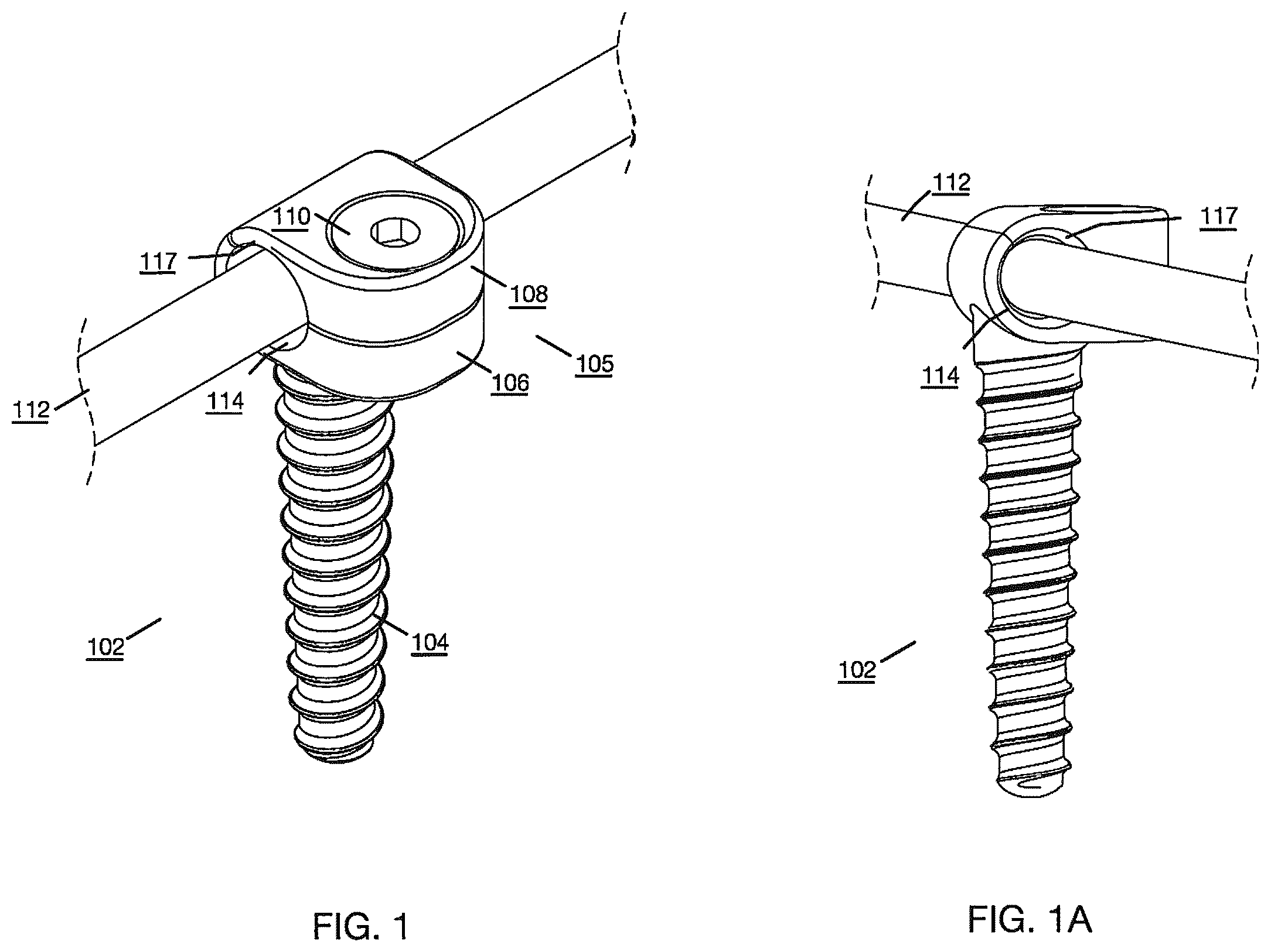 Patent US12496112 — Anchor device for bone implantation during surgical procedures — Figure 1