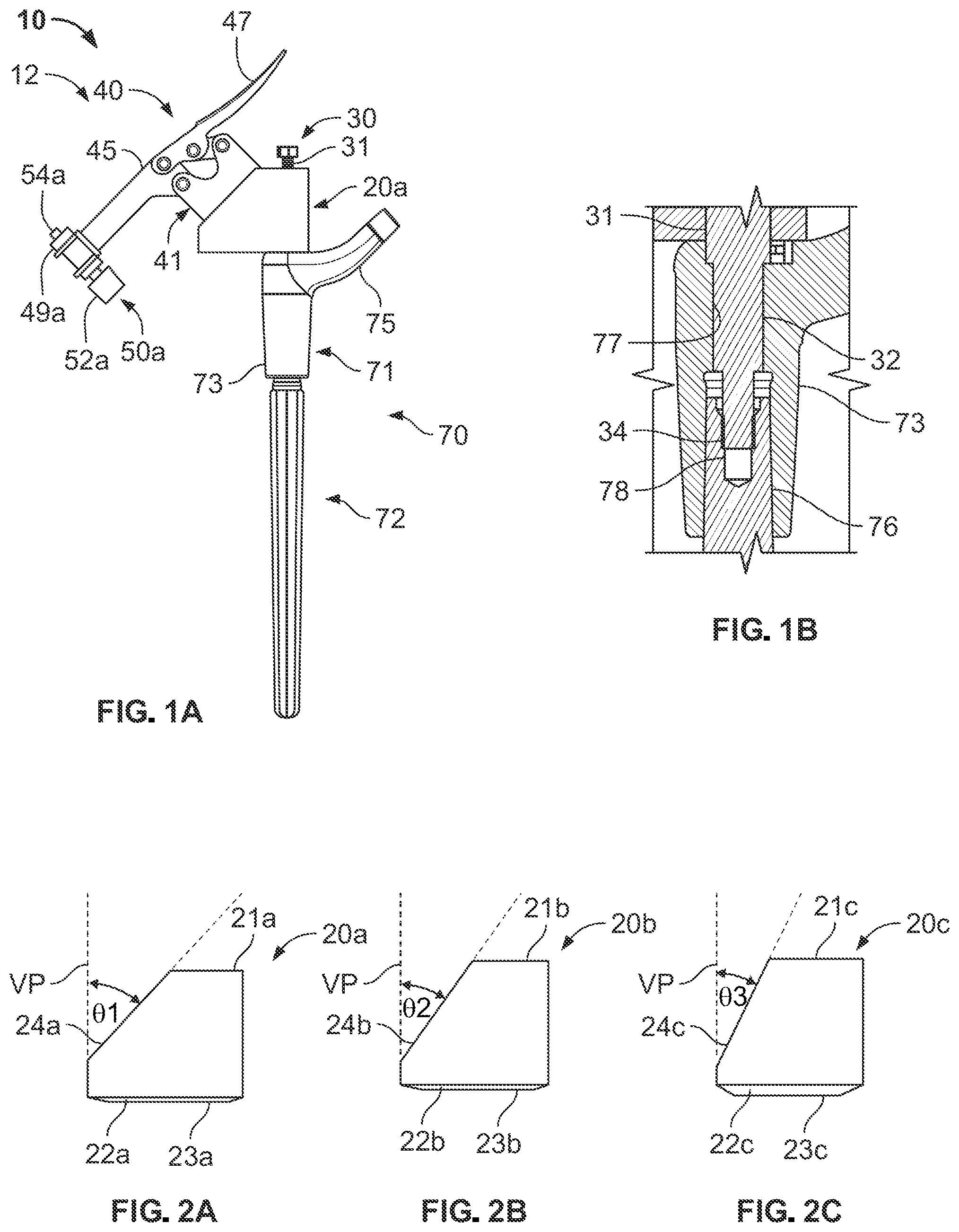 Patent US12496113 — Bone reattachment system — Figure 1