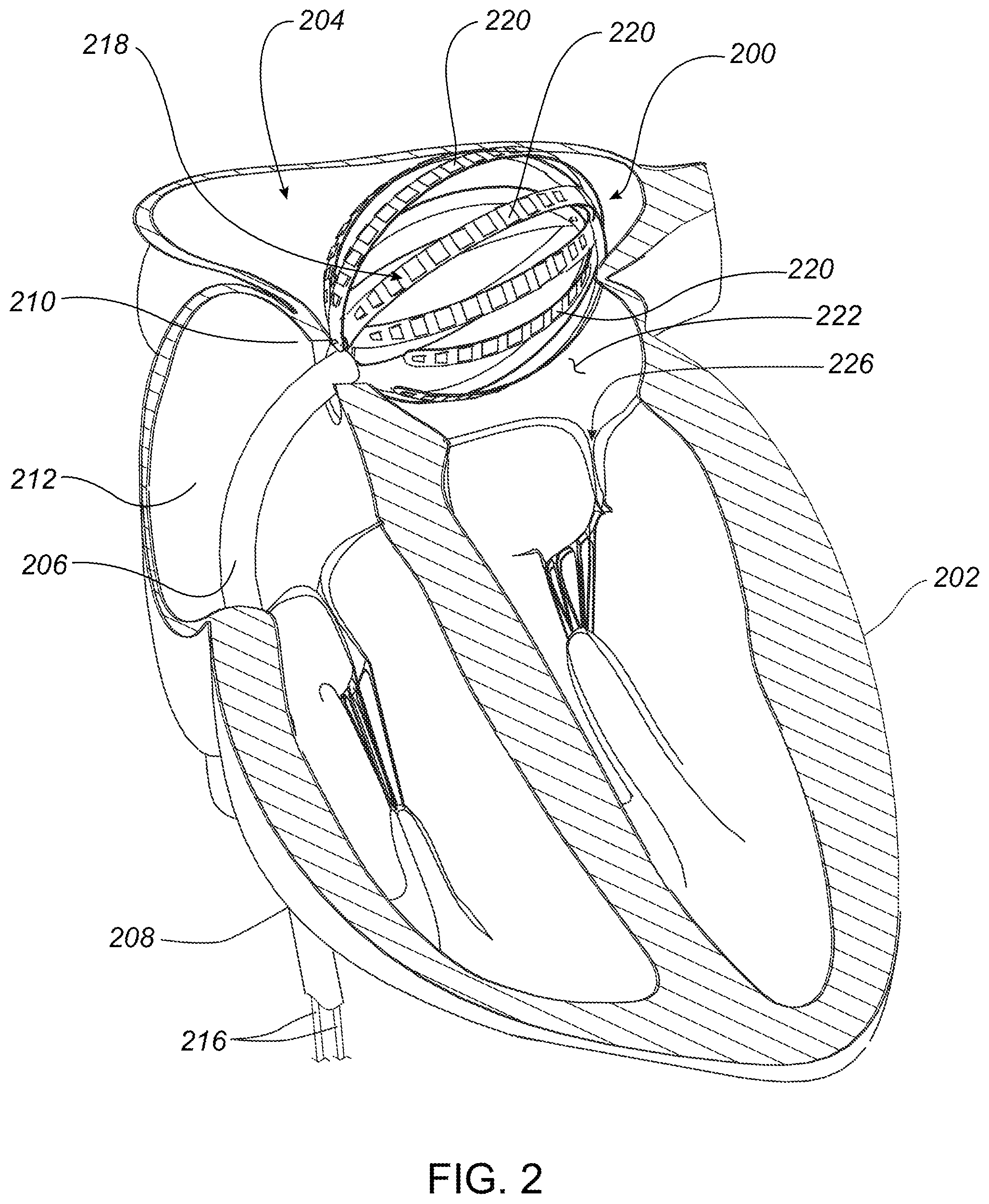 Patent US12496127 Figure 2 – High-density electrode-based medical device system