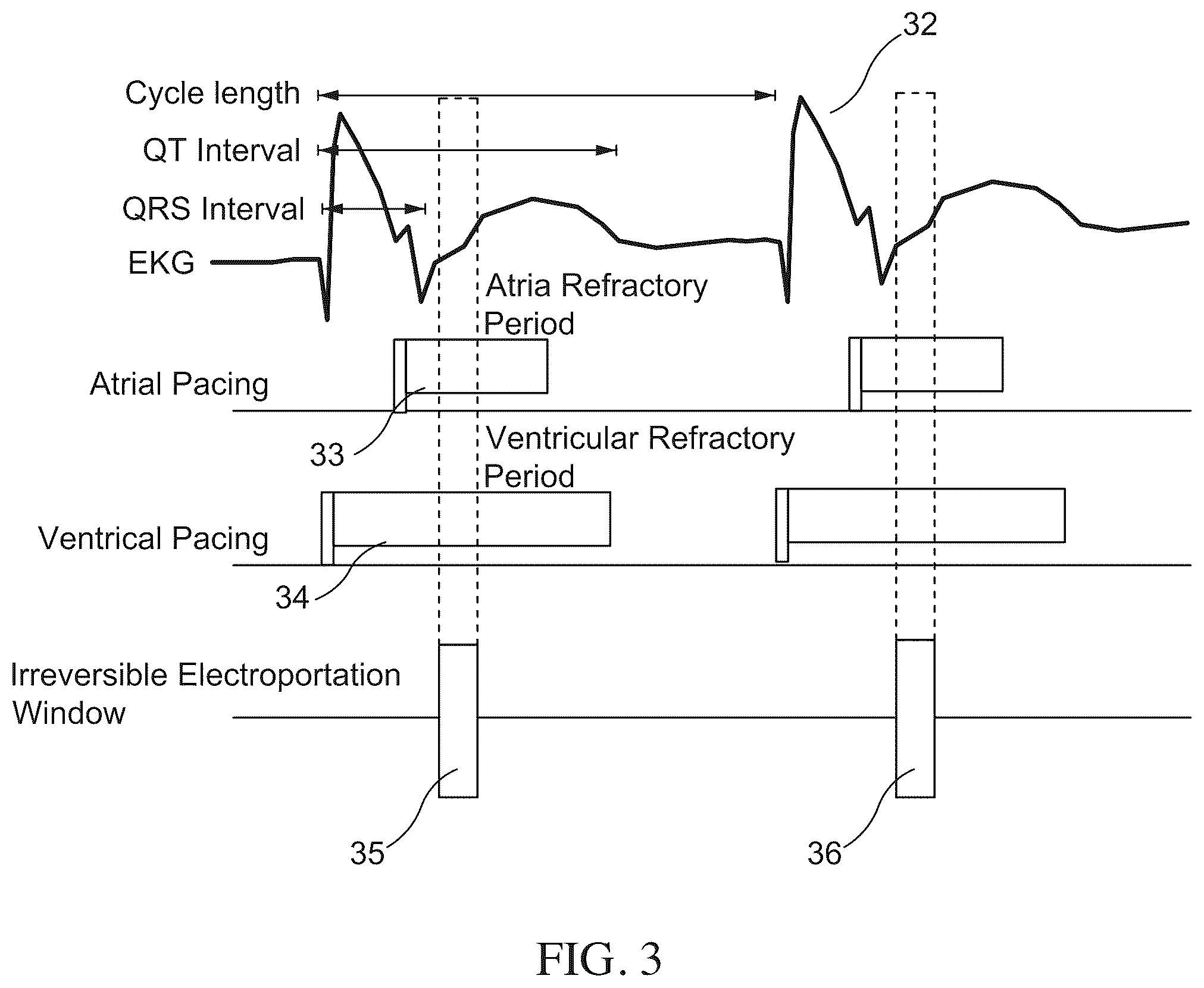 Patent US12496128 Figure 3 – Methods and apparatus for selective tissue ablation