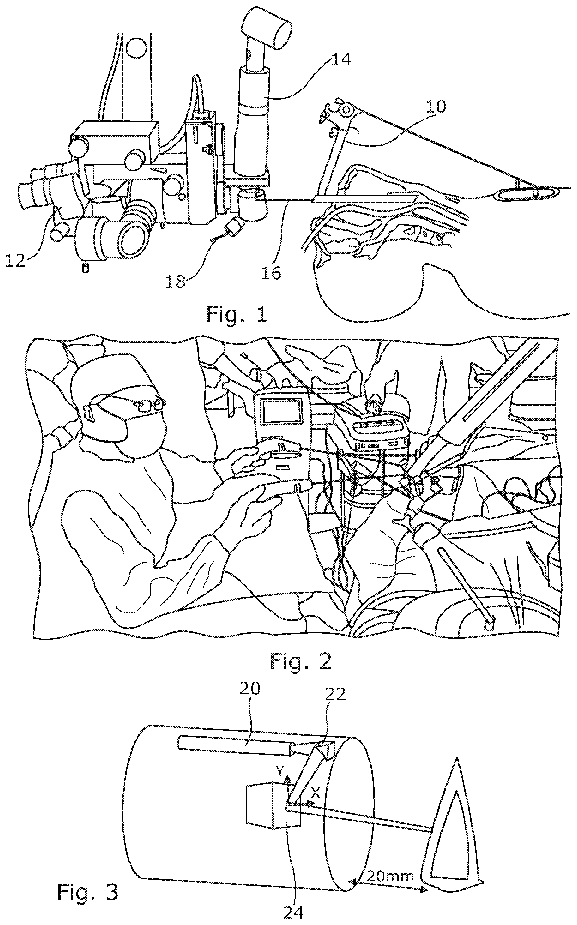 Patent US12496131 — Trans-oral surgery device comprising a blade with a distal scaffold and a support adjustable through tendons — Figure 1
