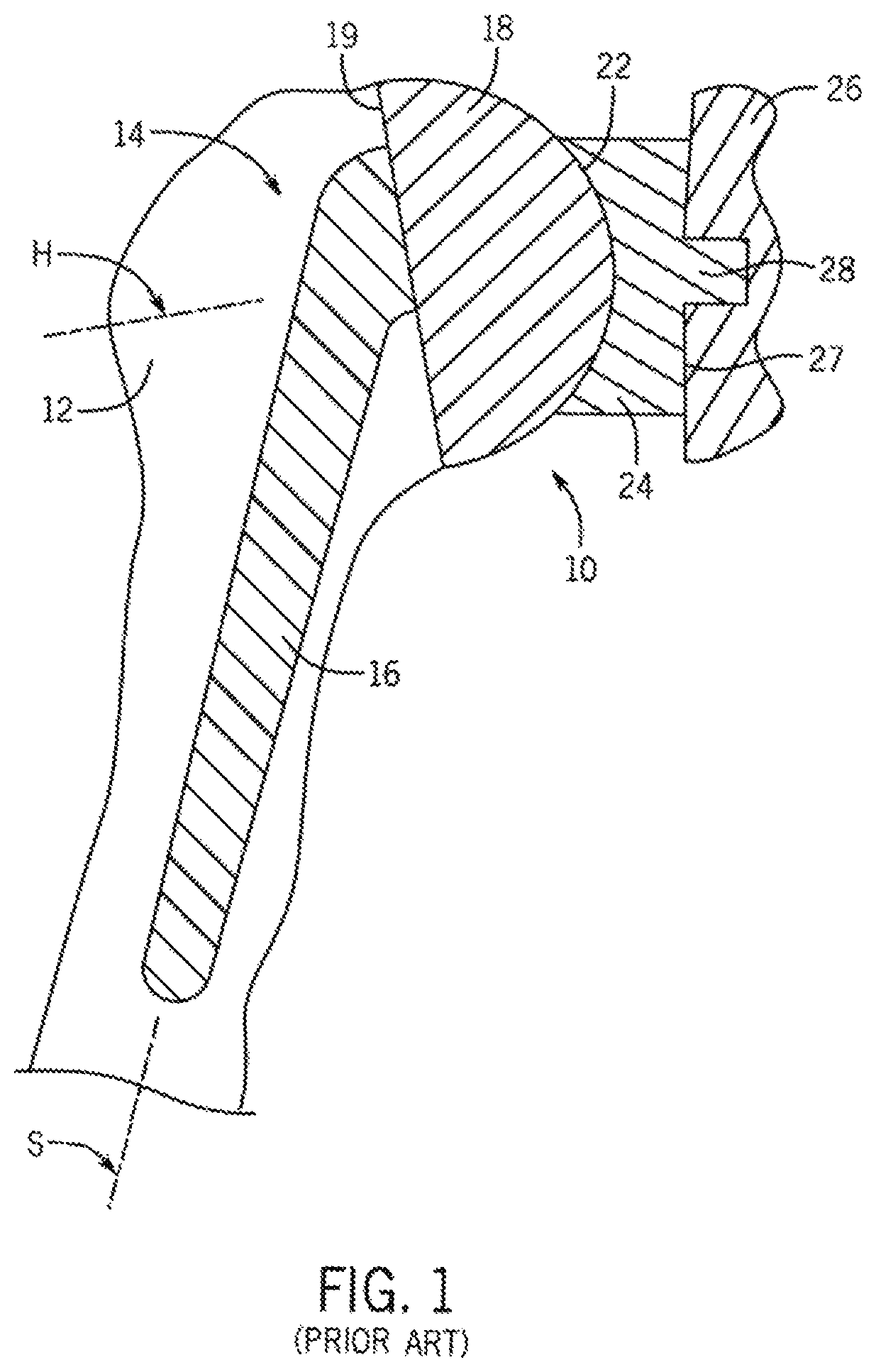 Patent US12496134 — Method for optimization of orthopedic component design — Figure 1