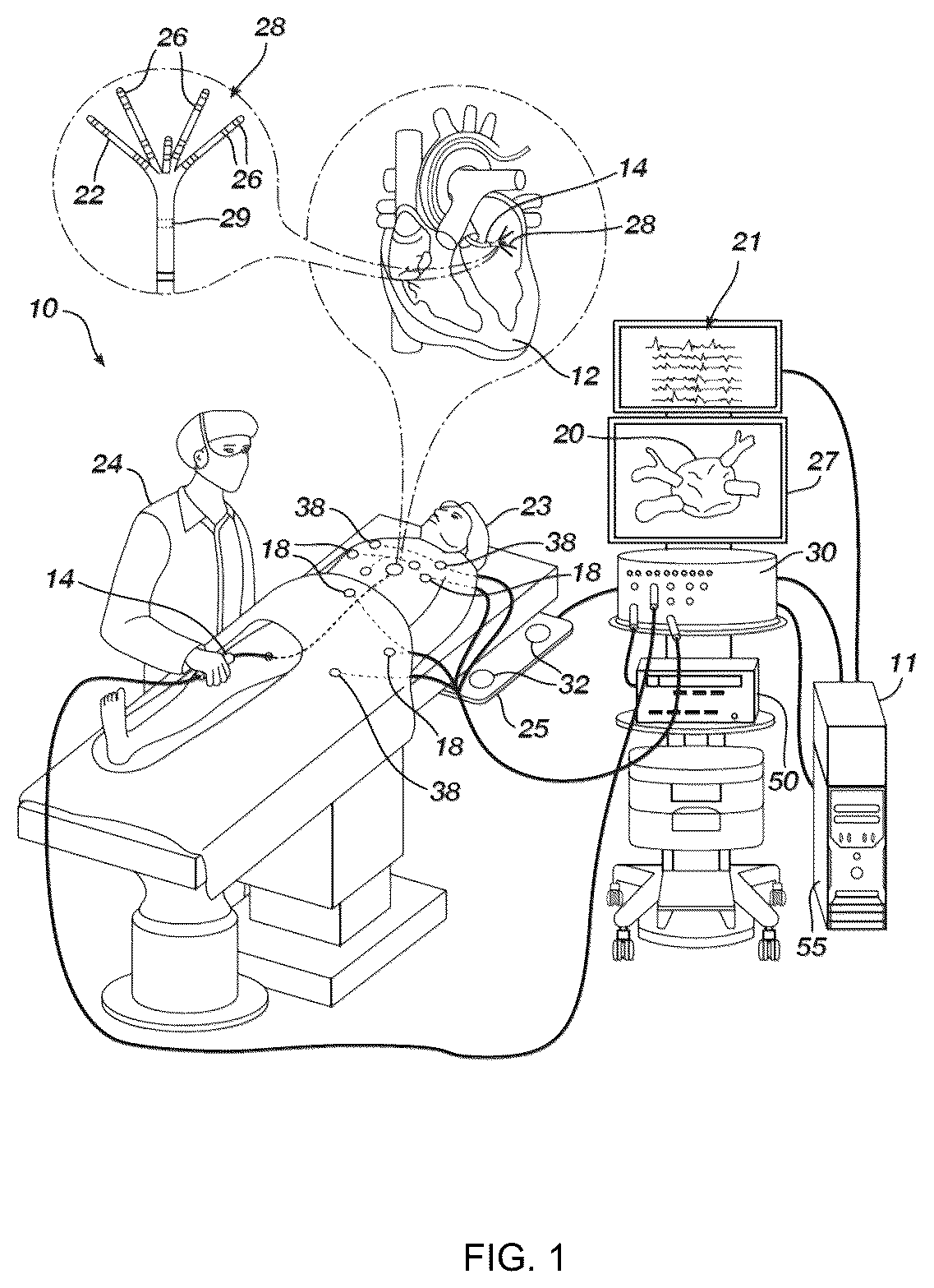 Patent US12496138 — Automated tool for identifying and correcting tenting artifacts in anatomical mapping — Figure 1