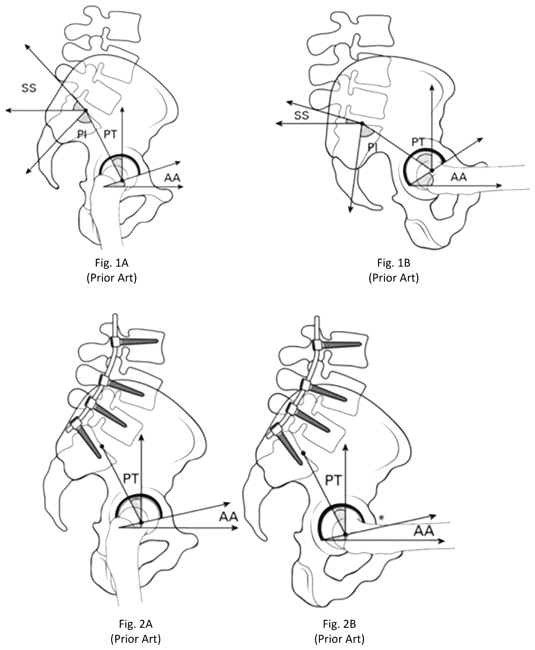 Patent US12496139 — System and method for pre-planning a procedure — Figure 1
