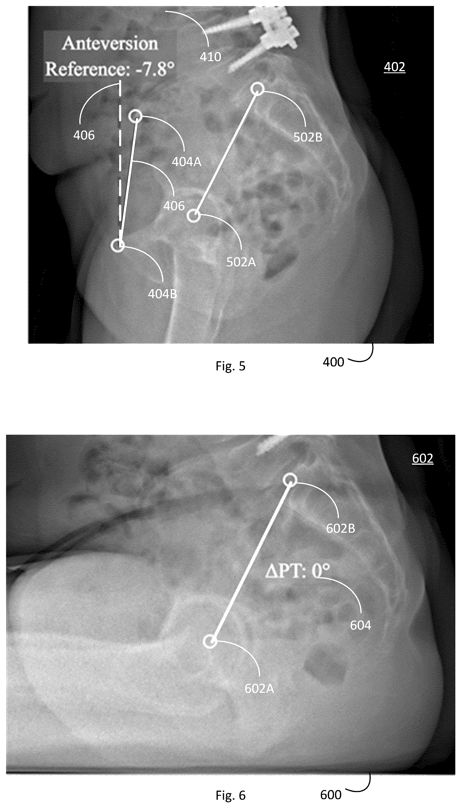Patent US12496139 Figure 4 – System and method for pre-planning a procedure