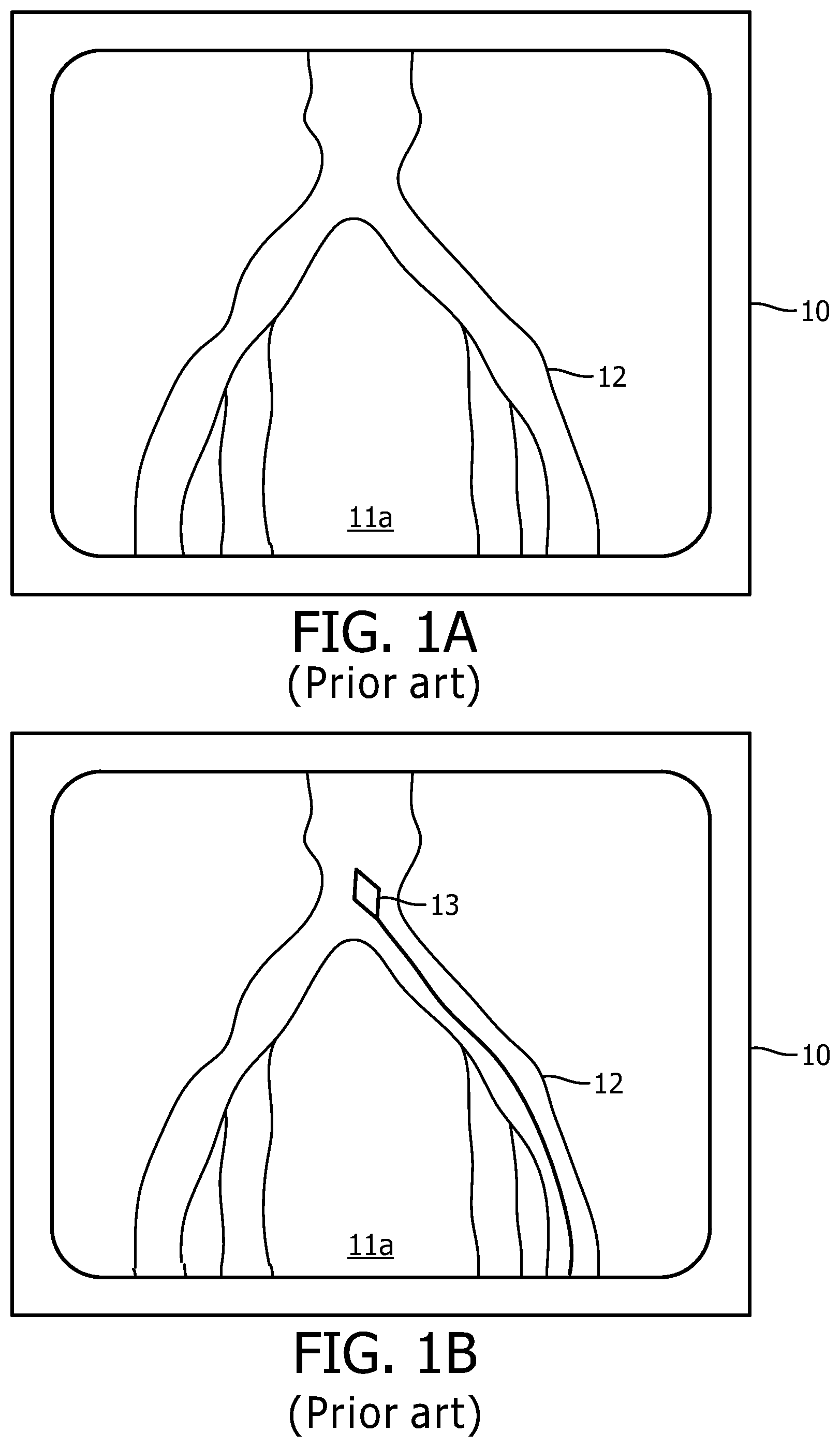 Patent US12496140 — Automatic field of view updating of position tracked interventional device — Figure 1