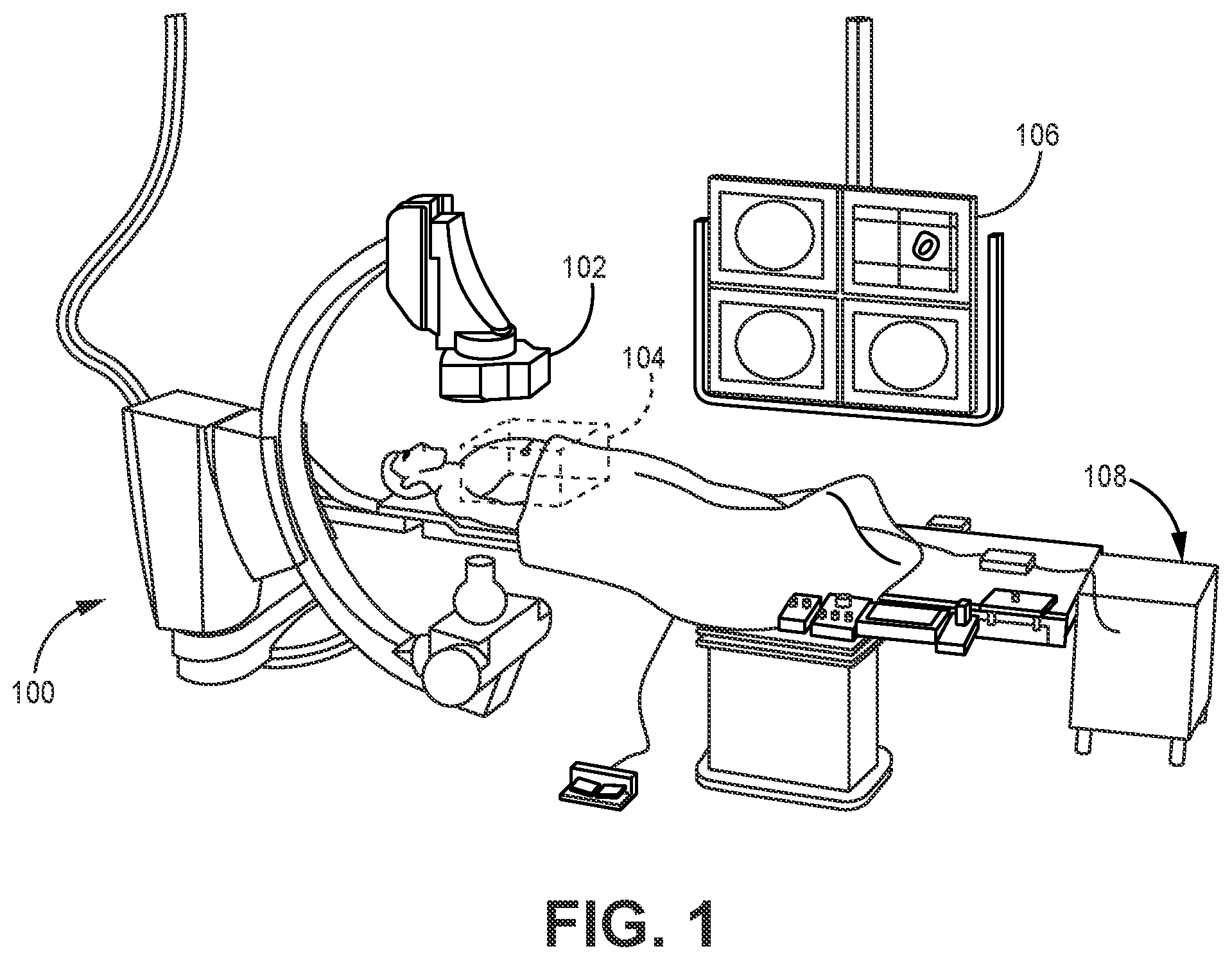 Patent US12496143 — Systems and methods for detecting catheter deliberate motion — Figure 1