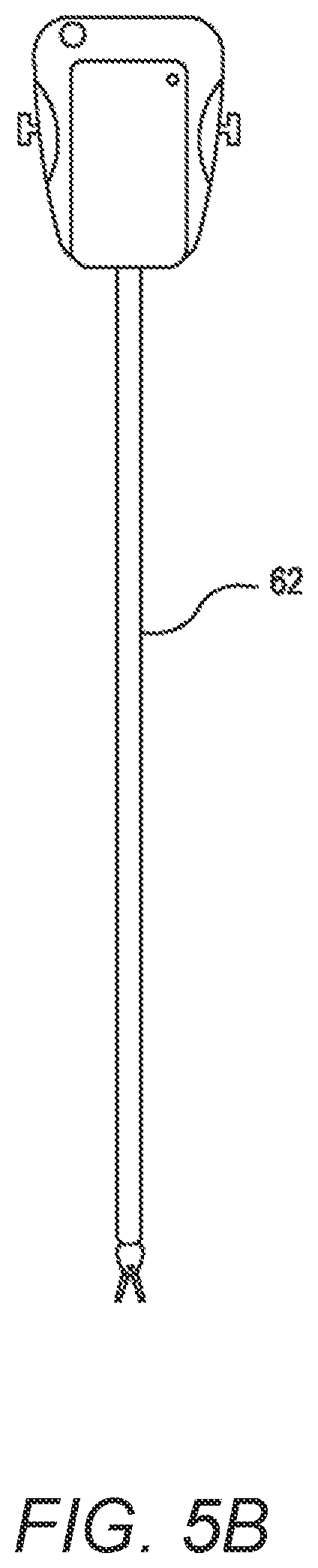 Patent US12496157 Figure 4 – Redundant axis and degree of freedom for hardware-constrained remote center robotic manipulator