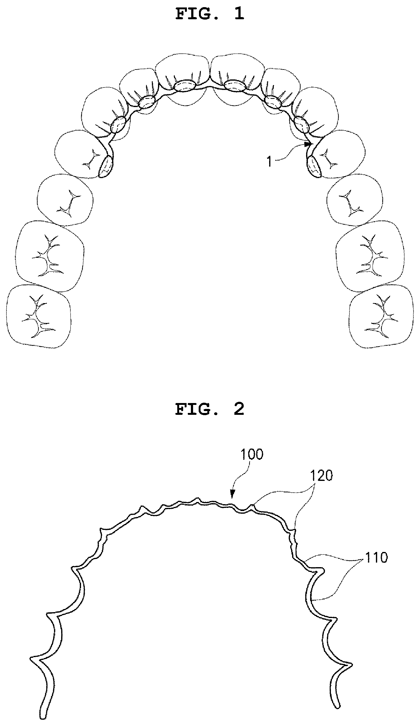 Patent US12496167 — Adhesive retainer and manufacturing method therefor — Figure 1