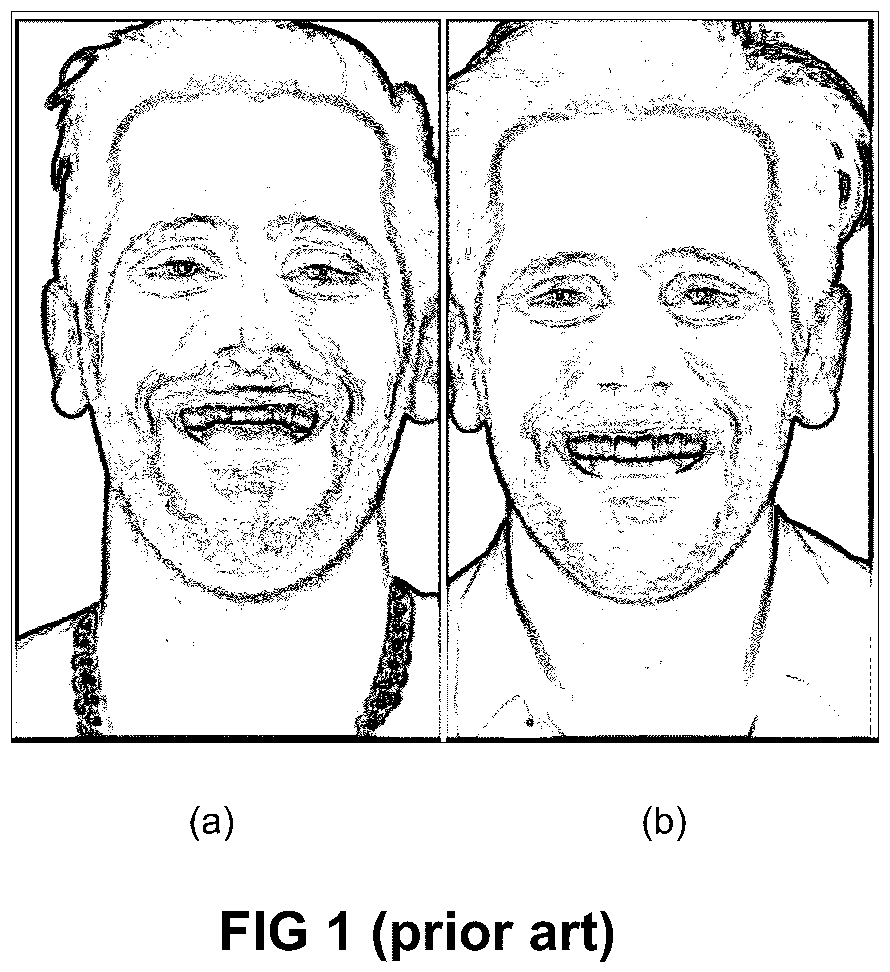Patent US12496172 — Computer implemented methods for dental design — Figure 1