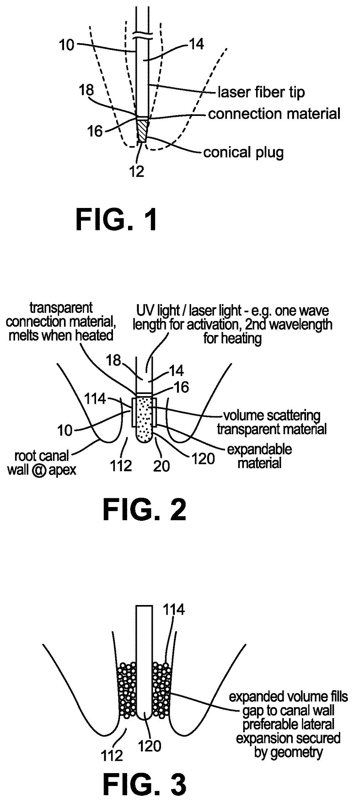 Patent US12496175 — Method and arrangement for cleaning of a canal — Figure 1