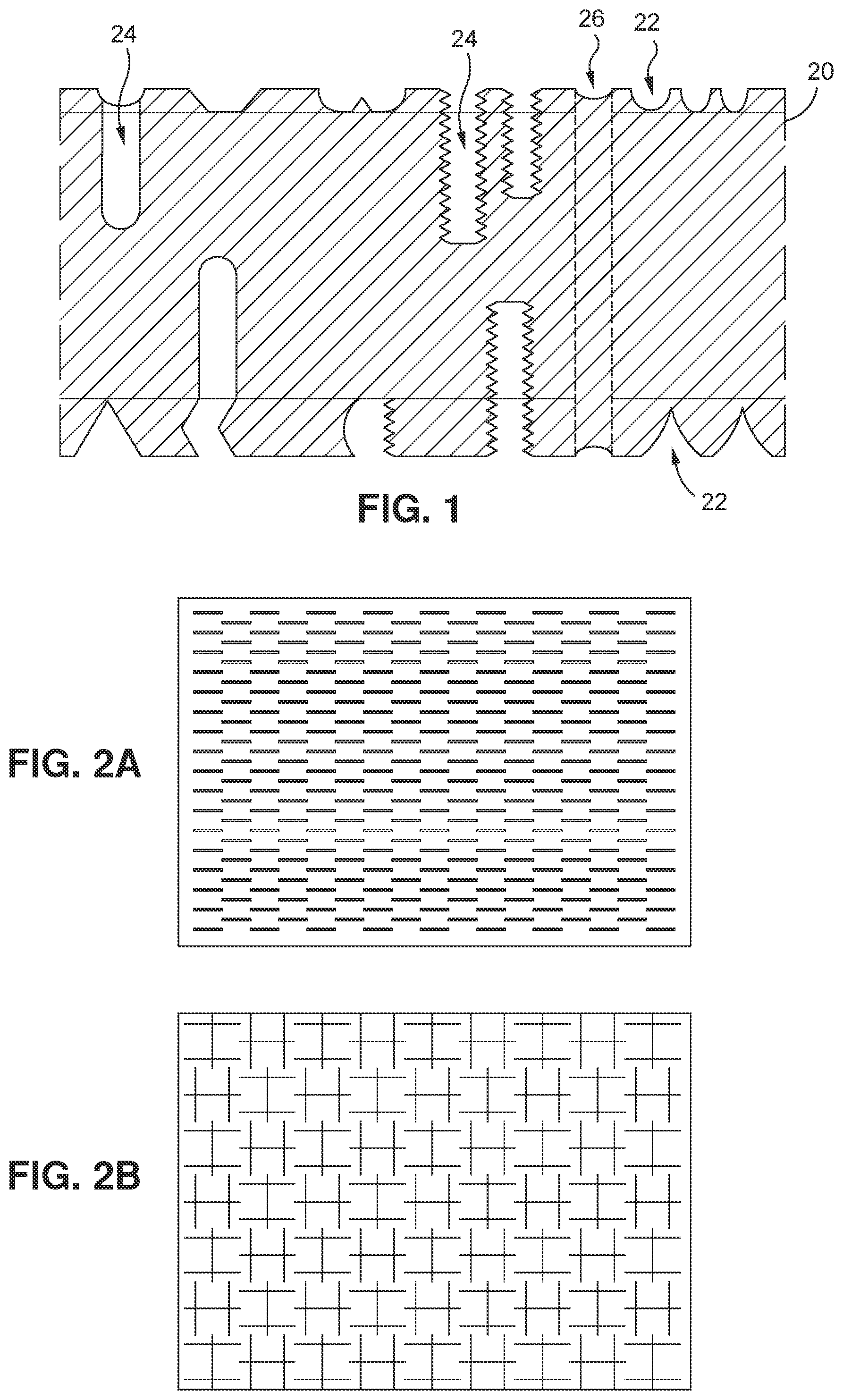 Patent US12496179 — Method and apparatus for creating a modified tissue graft — Figure 1