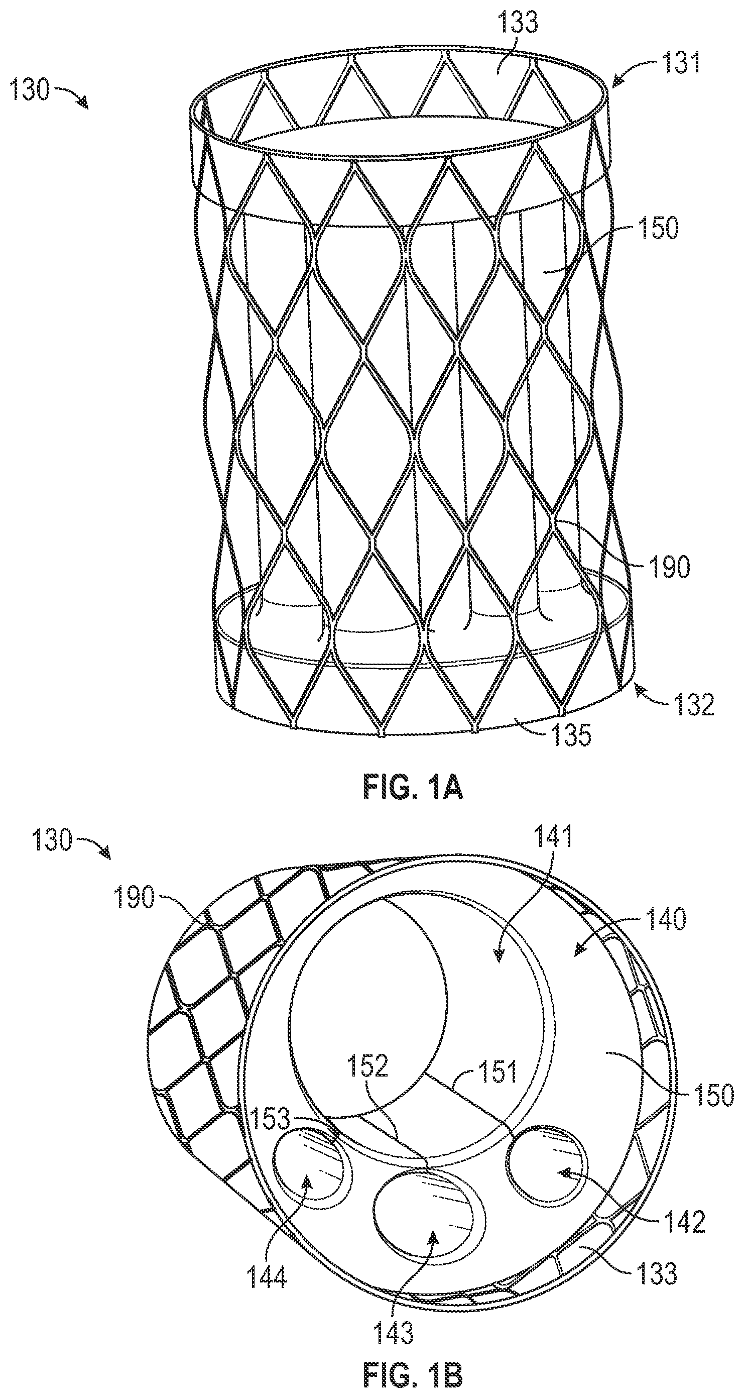 Patent US12496182 — Multi-lumen stent-graft and related surgical methods — Figure 1