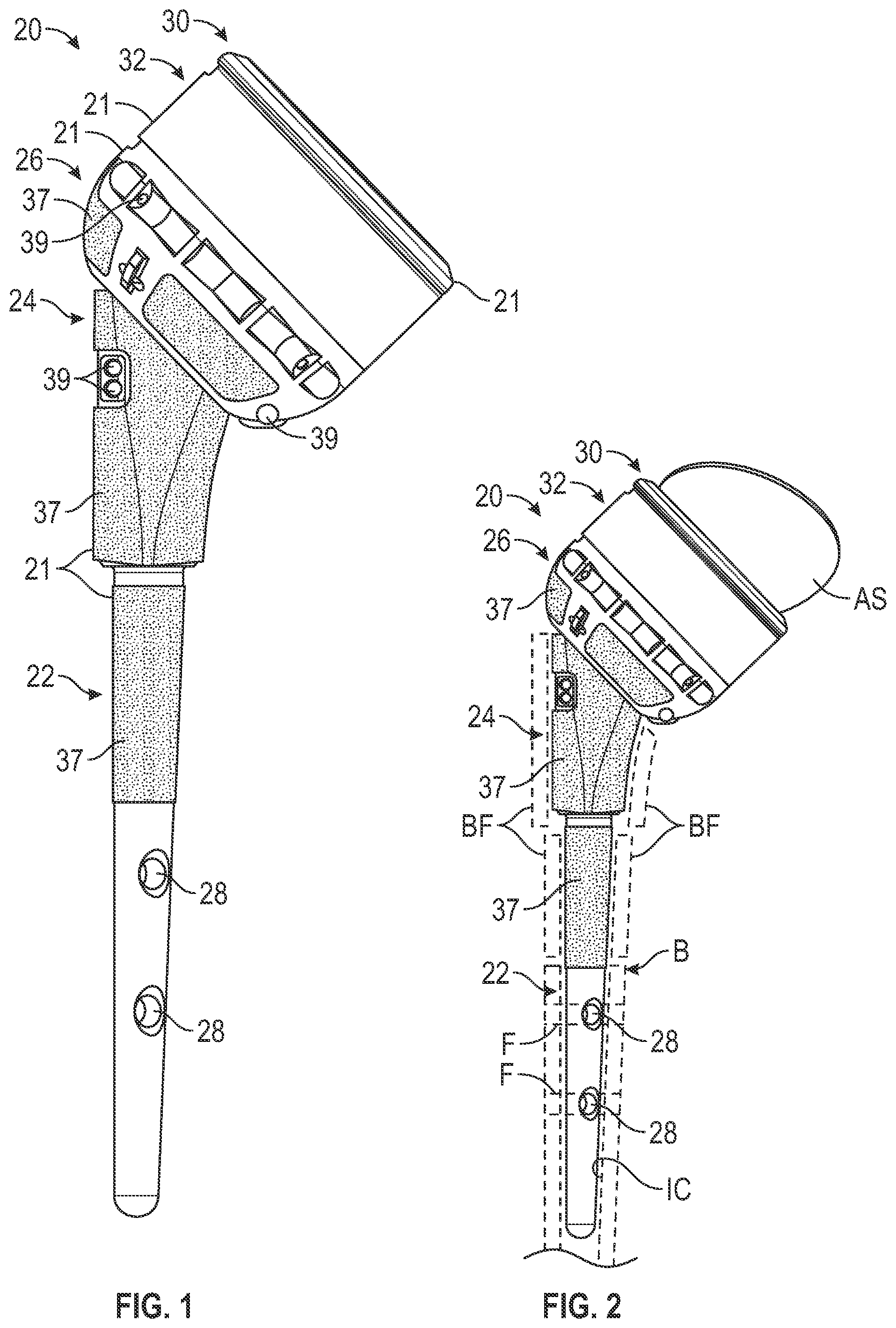 Patent US12496192 — Hydraulic taper separator for orthopaedic implant systems and methods of disassembly — Figure 1