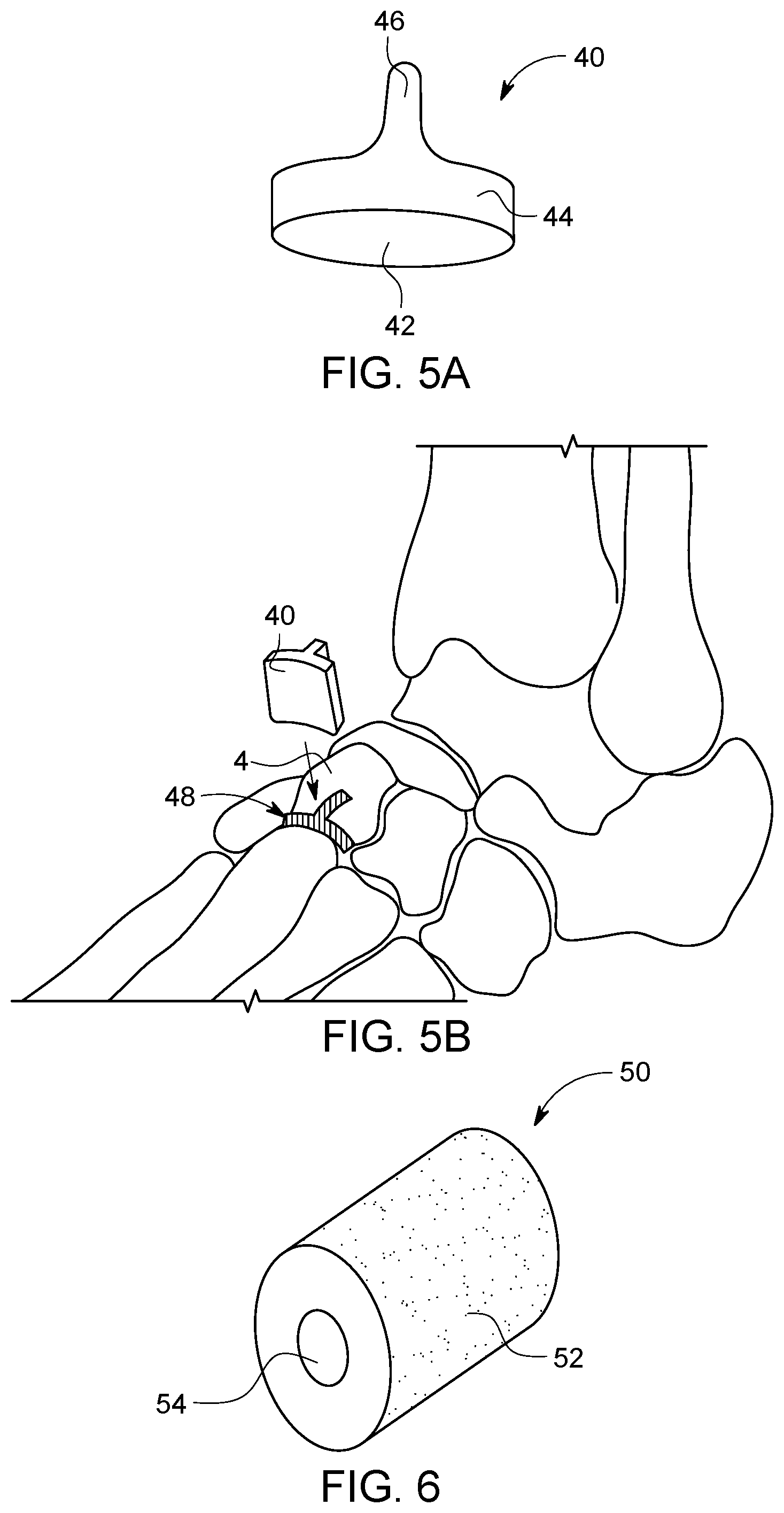 Patent US12496198 Figure 3 – Dowel guide instrument and method for treating mid-foot disorders