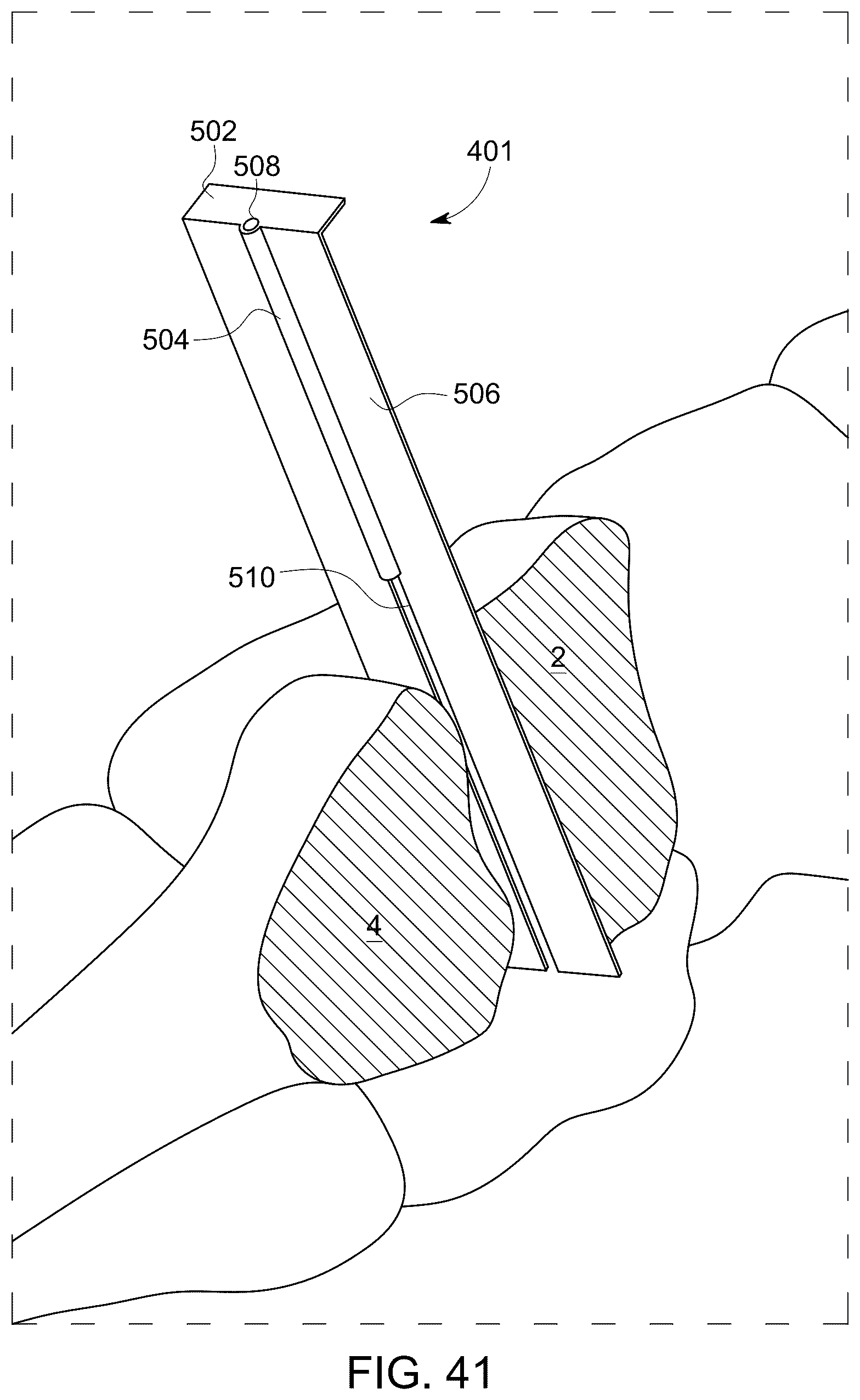 Patent US12496198 Figure 18 – Dowel guide instrument and method for treating mid-foot disorders