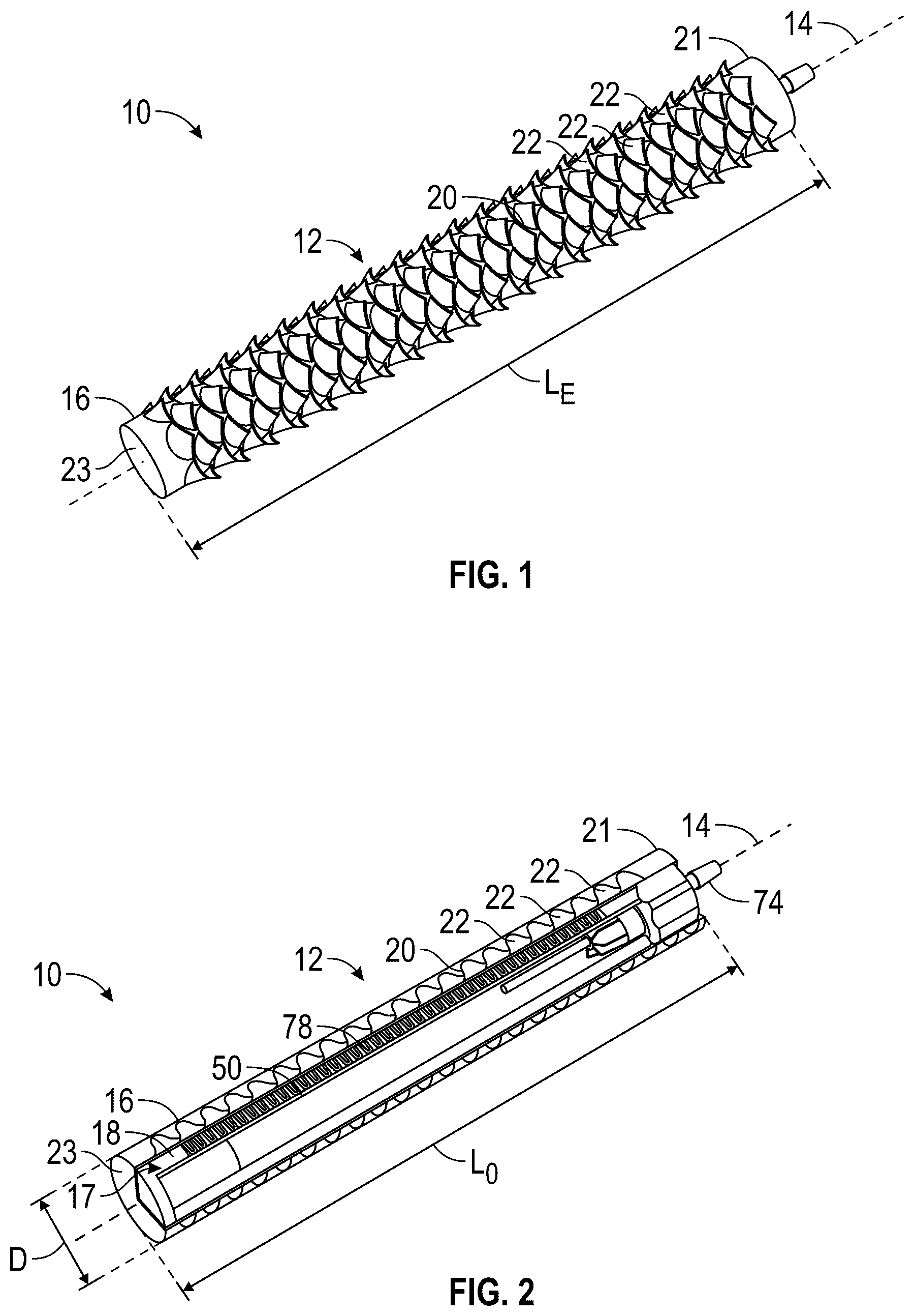 Patent US12496200 — Kirigami-inspired stents for sustained local delivery of therapeutics — Figure 1