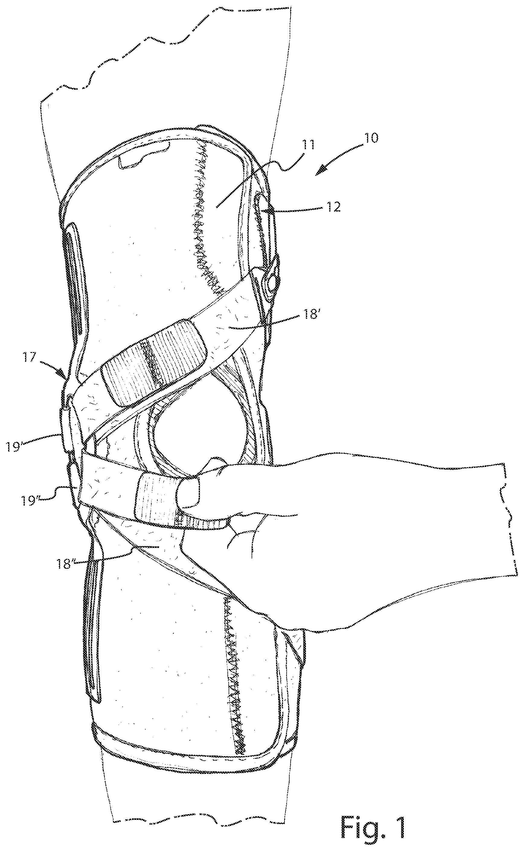 Patent US12496205 — Knee brace for the treatment of gonarthrosis — Figure 1