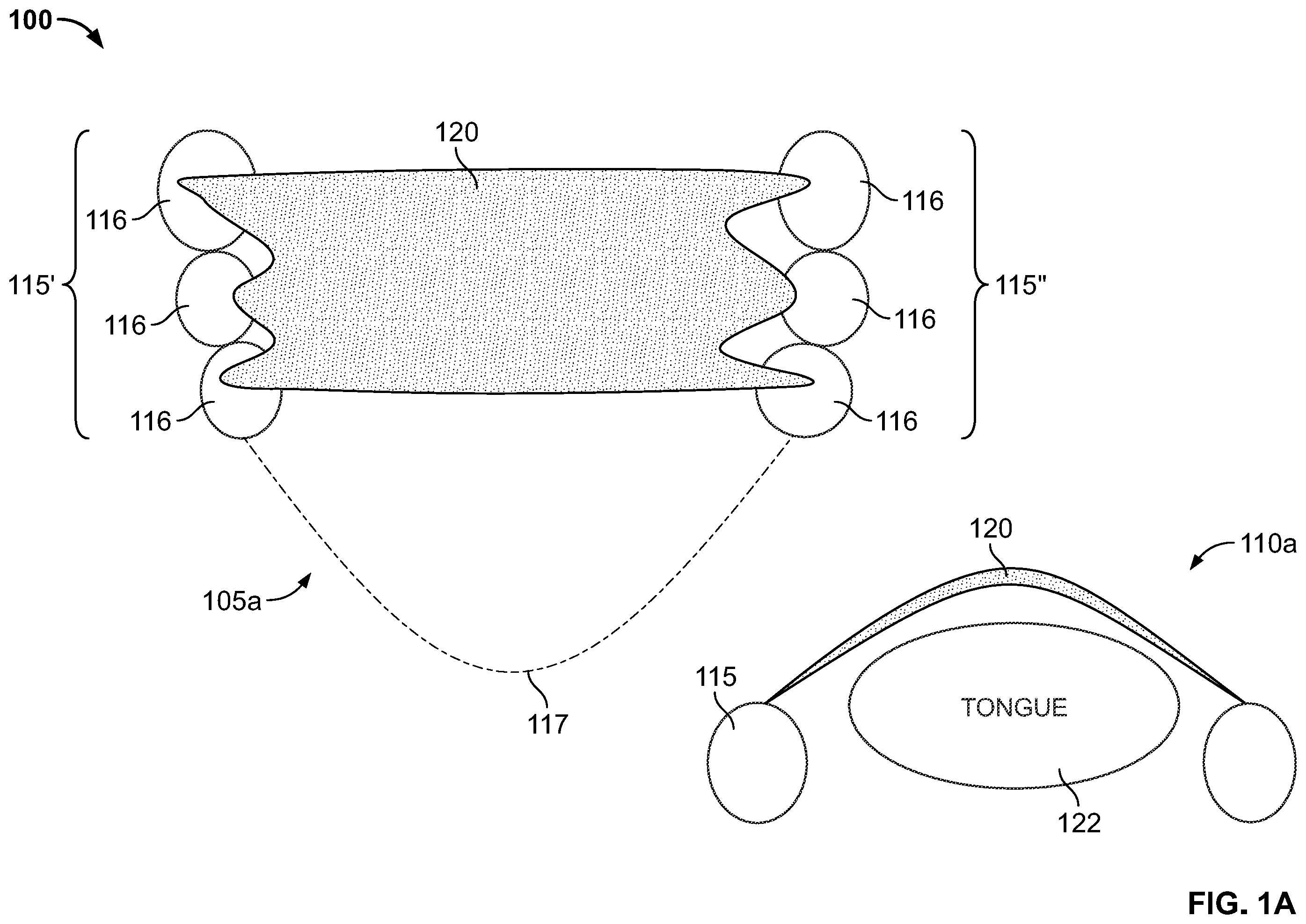 Patent US12496212 — Devices for treating obstructive sleep apnea — Figure 1