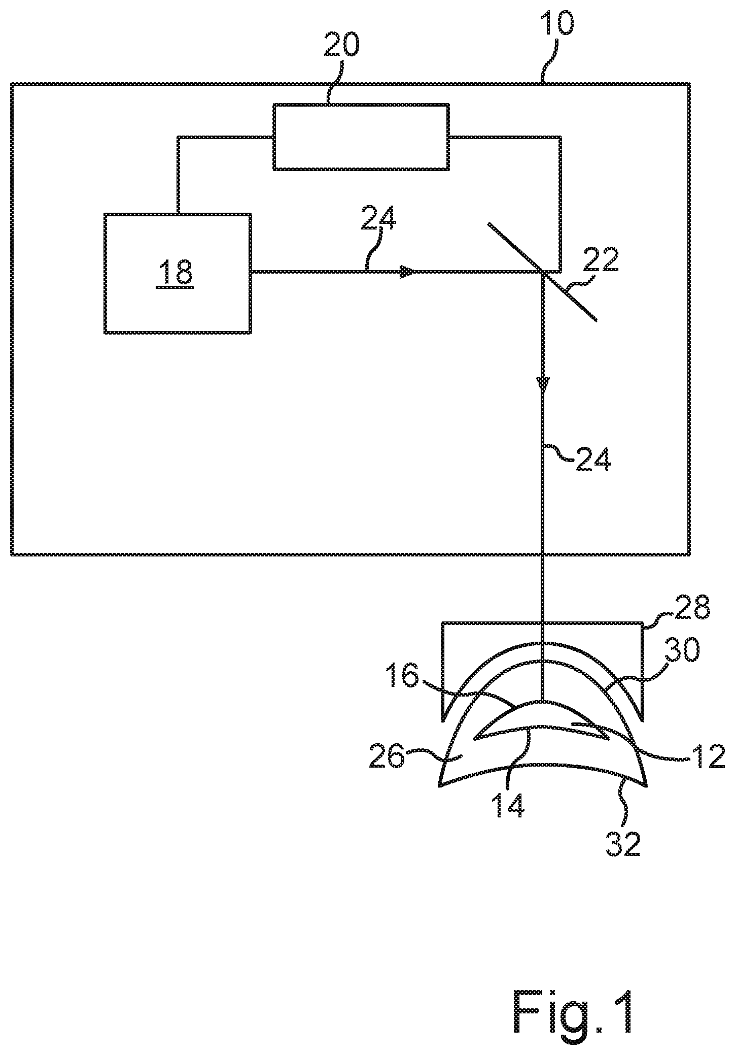 Patent US12496224 — Method for providing control data for a laser of a treatment apparatus — Figure 1