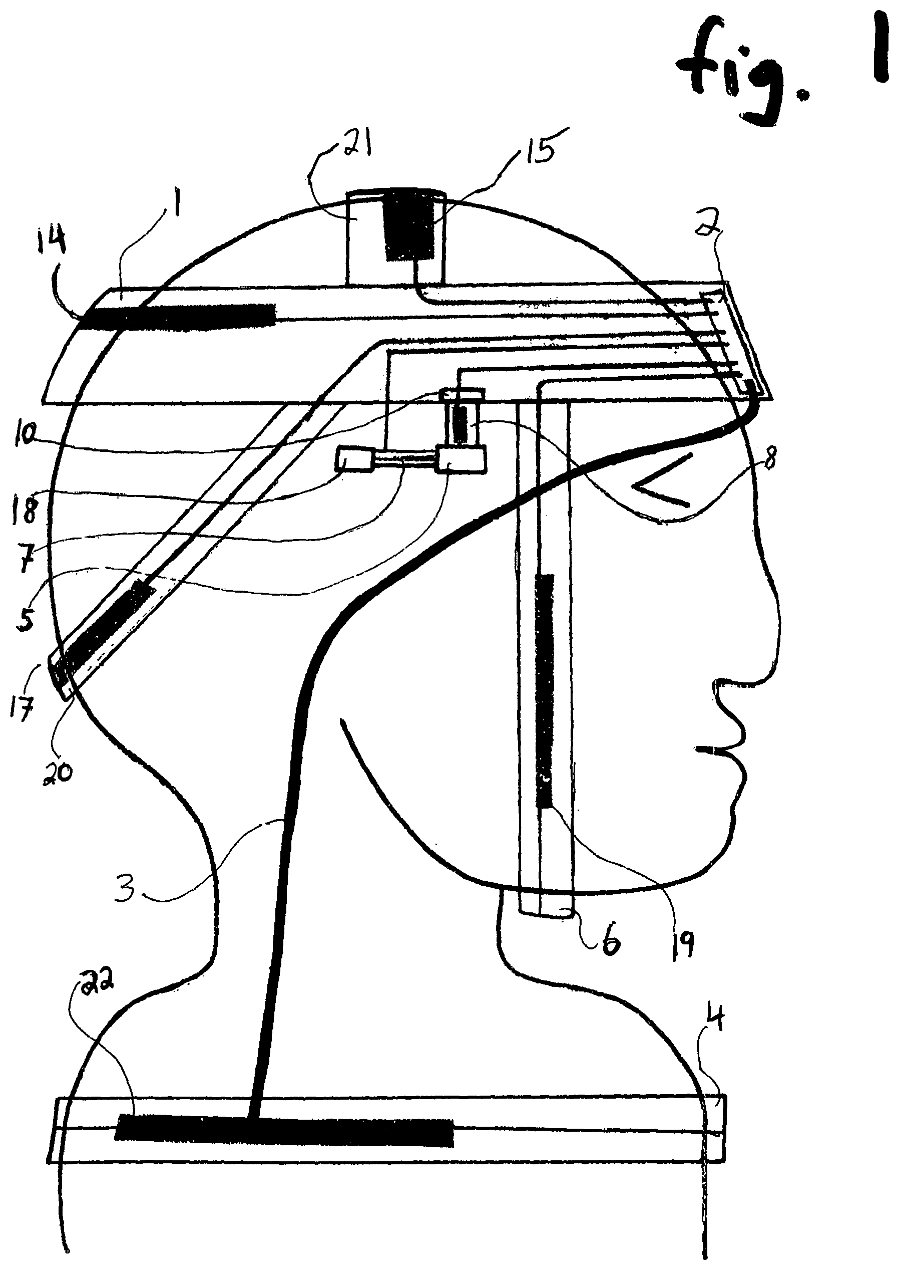 Patent US12496248 — Headband that contracts in synchrony with inspiration during sleep — Figure 1