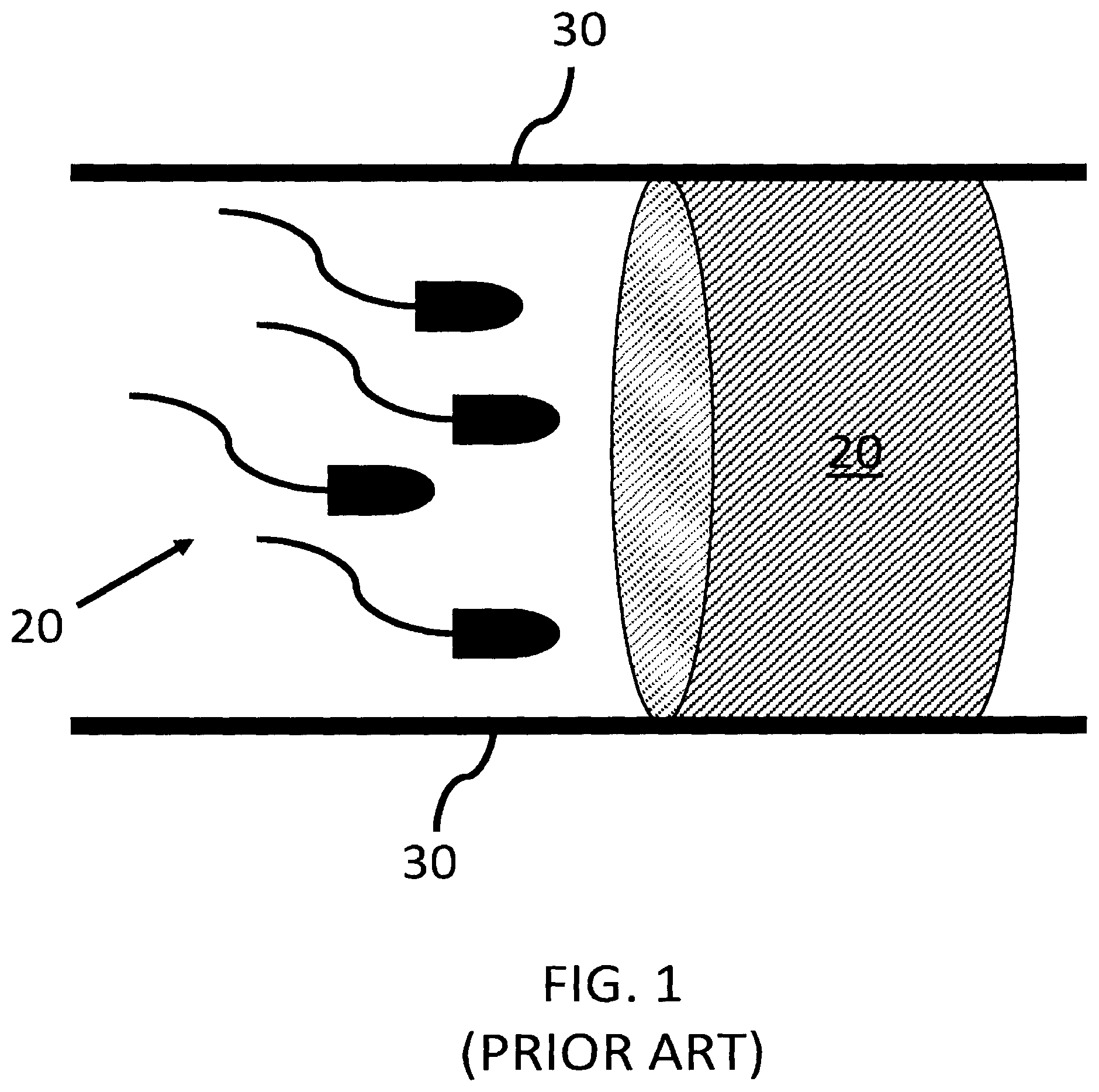 Patent US12496270 — Methods for reversible male birth control — Figure 1