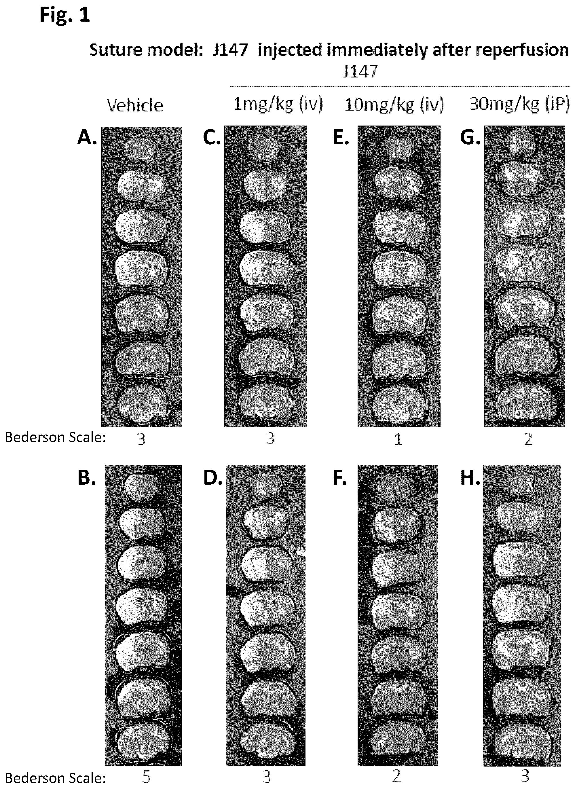 Patent US12496281 — Compounds for prevention and treatment of hemorrhage and vasculature instability — Figure 1