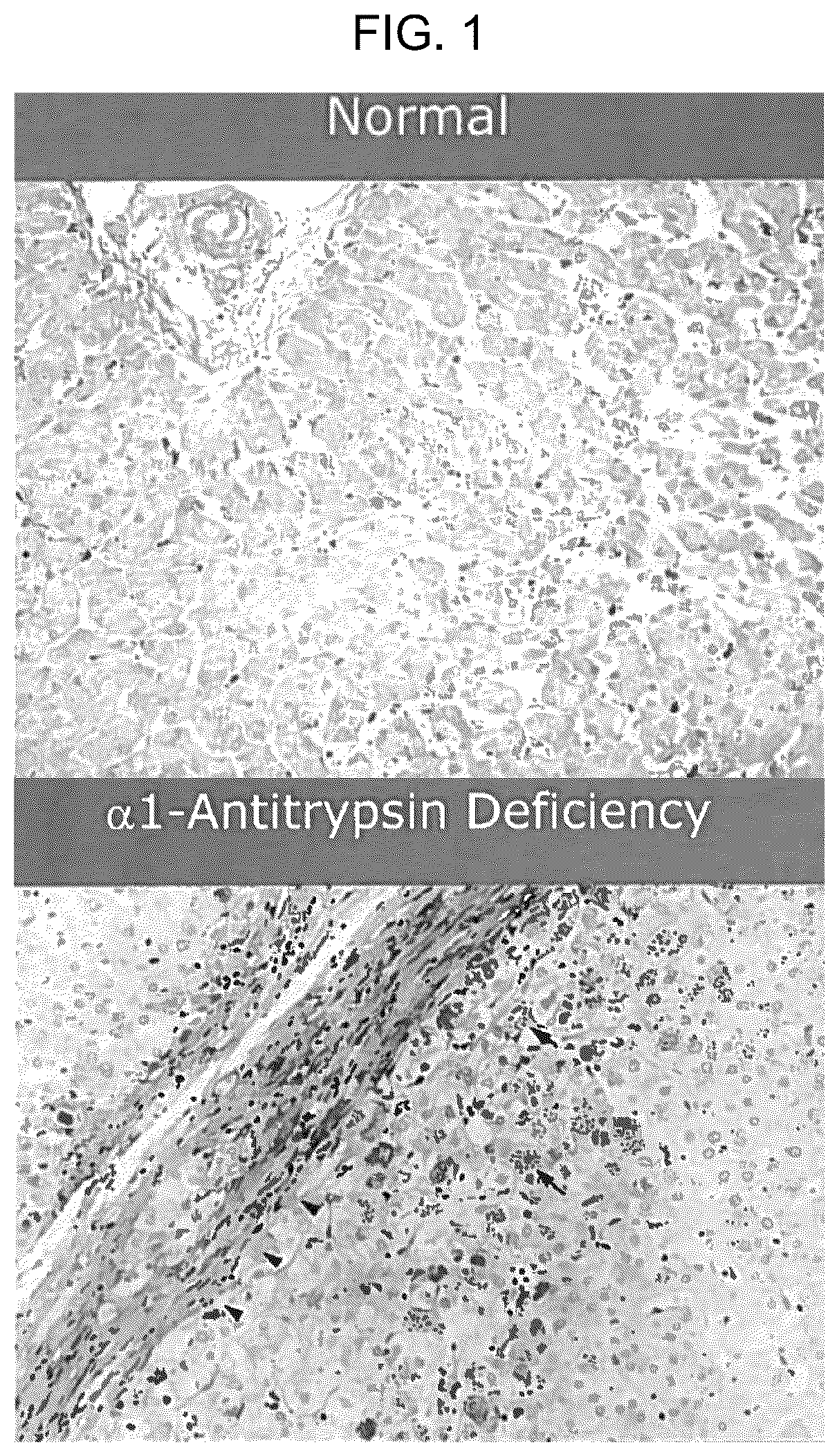 Patent US12496297 — Compositions of autophagy modulating agents and uses thereof — Figure 1