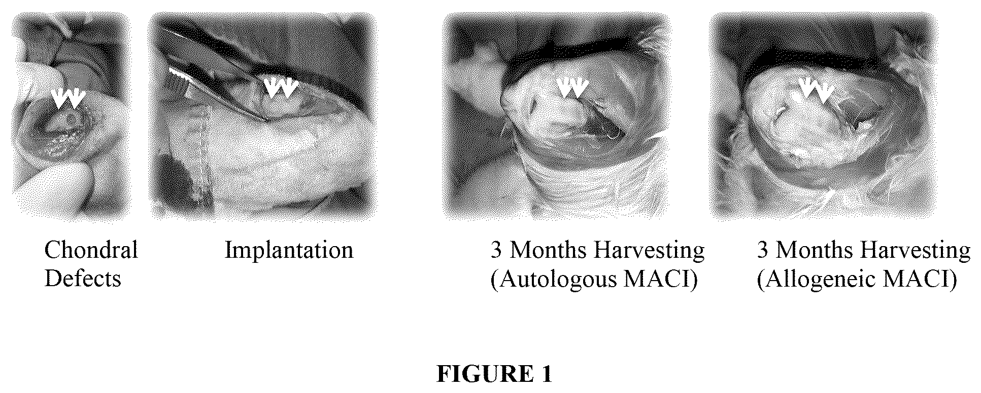 Patent US12496317 — Compositions and methods for repairing cartilage defects — Figure 1