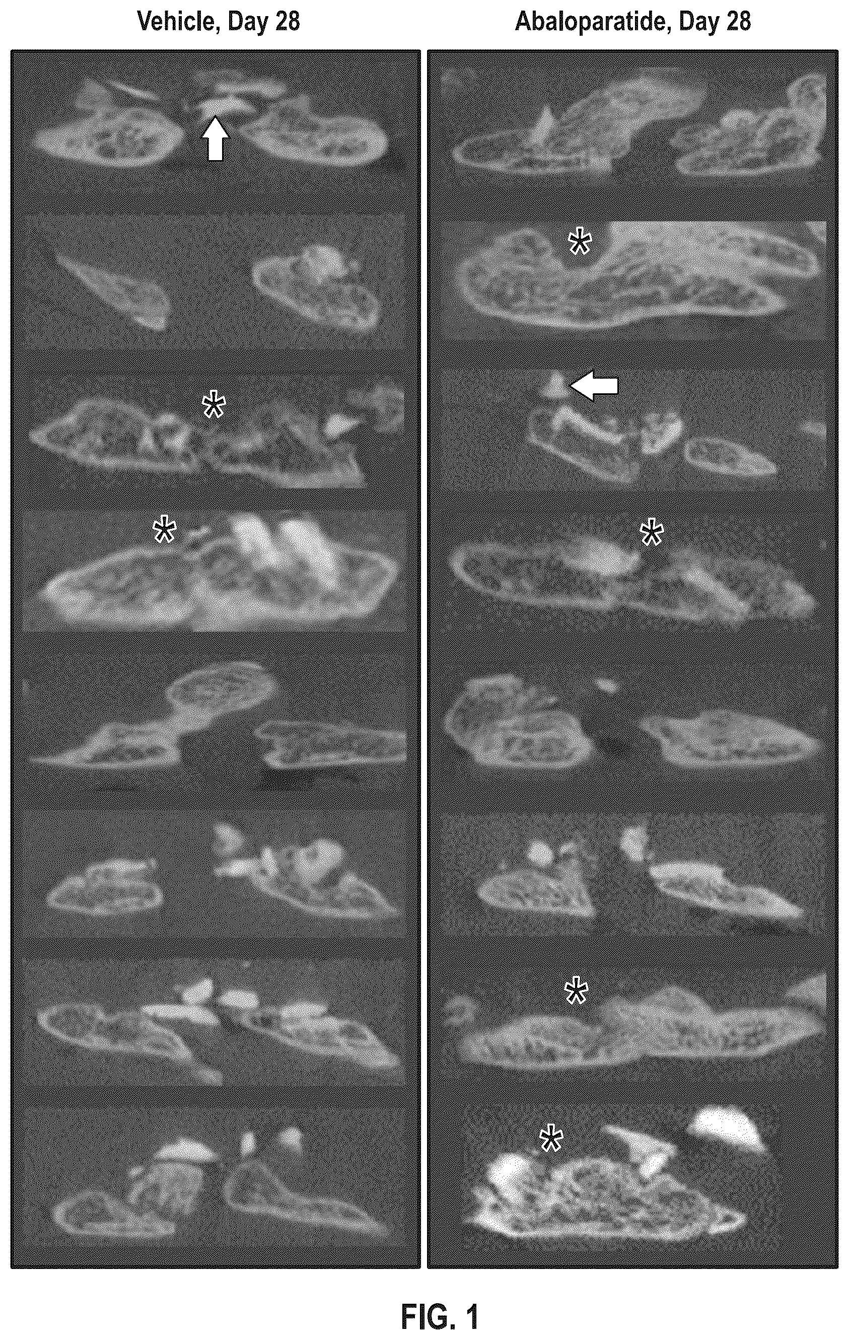 Patent US12496330 — Methods of improving spinal fusion with abaloparatide — Figure 1
