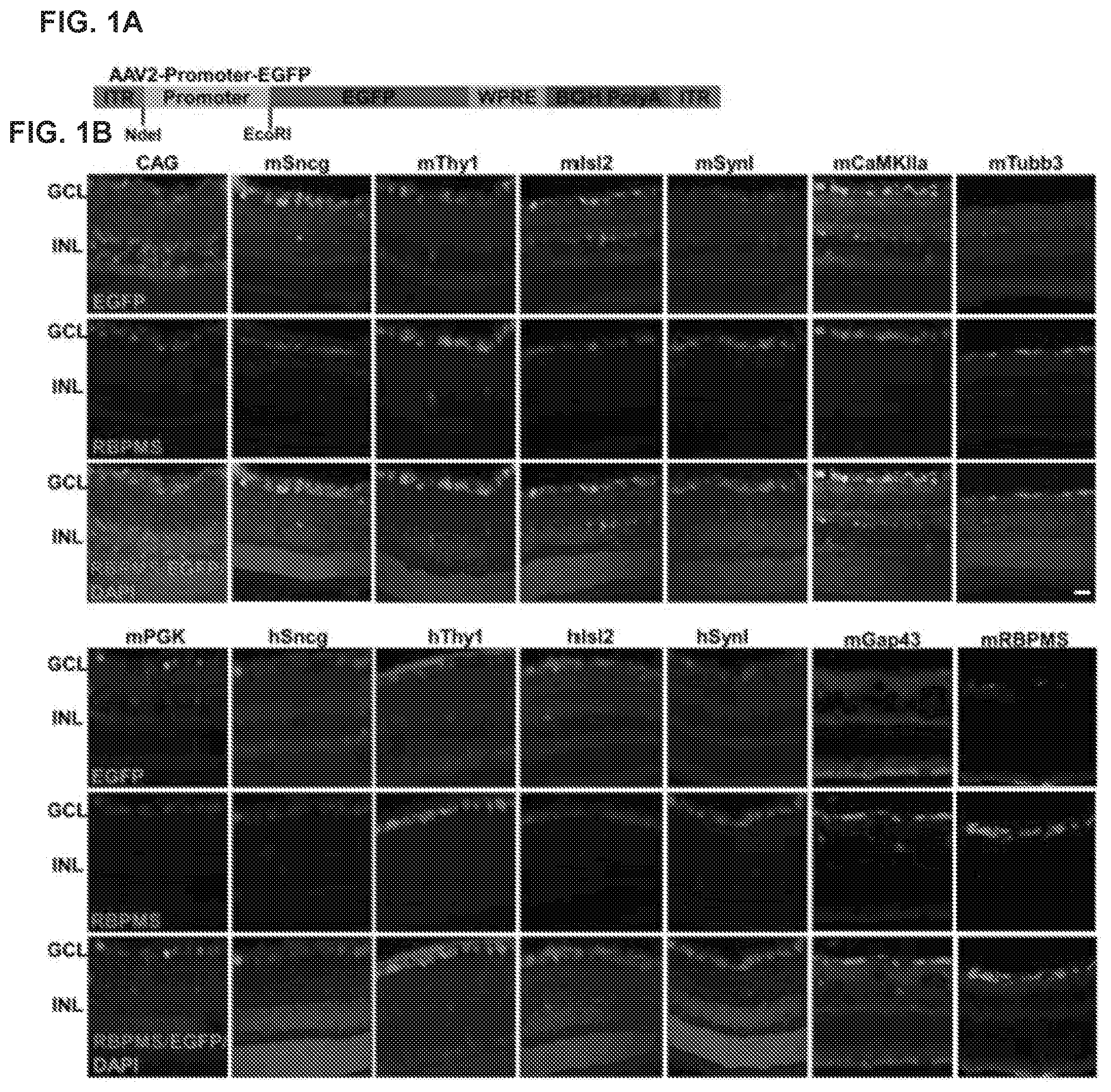 Patent US12496356 — Neuroprotection of neuronal soma and axon by modulating ER stress/UPR molecules — Figure 1