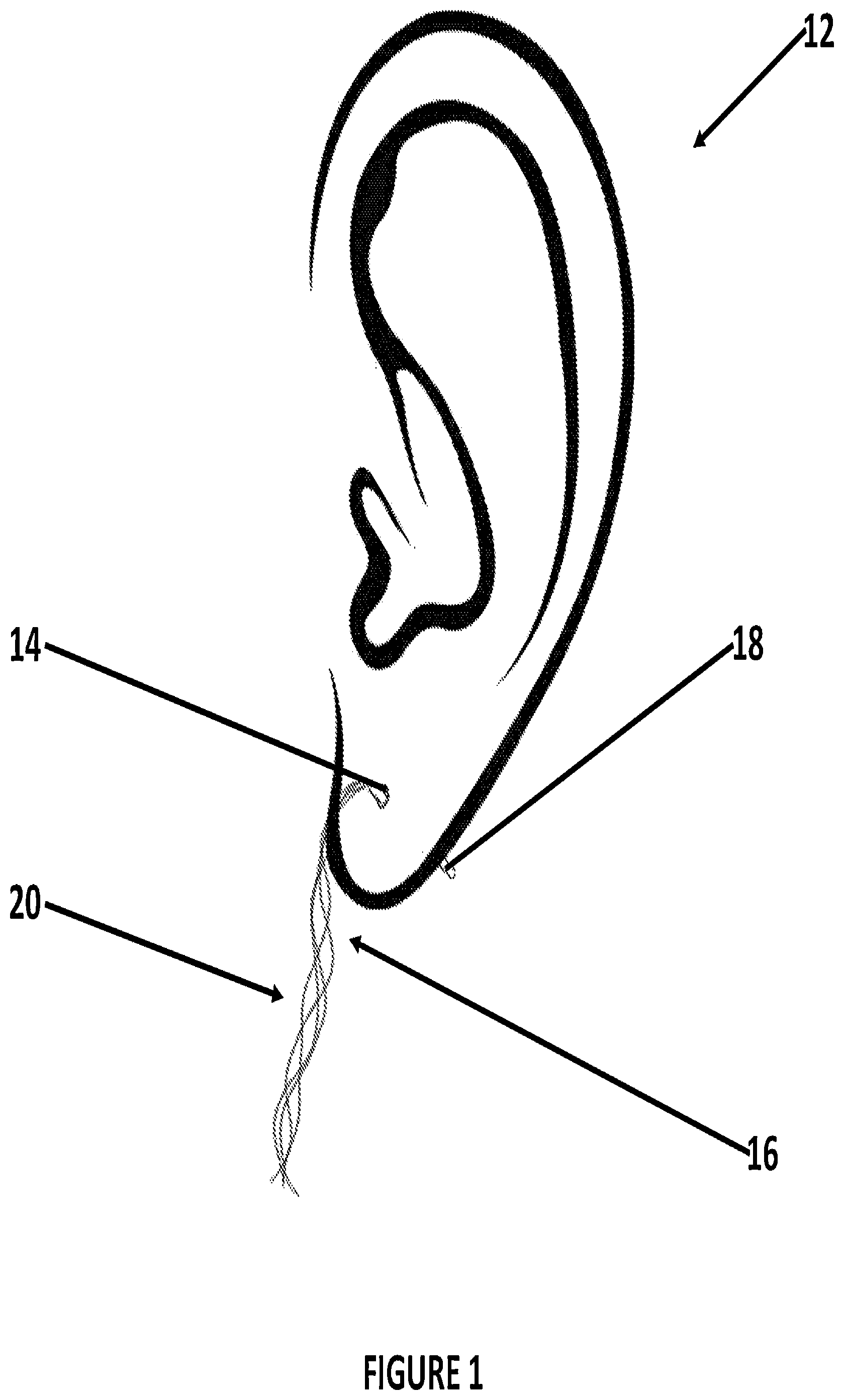 Patent US12496364 — Pierced body part hole cleaning kit and method for cleaning — Figure 1