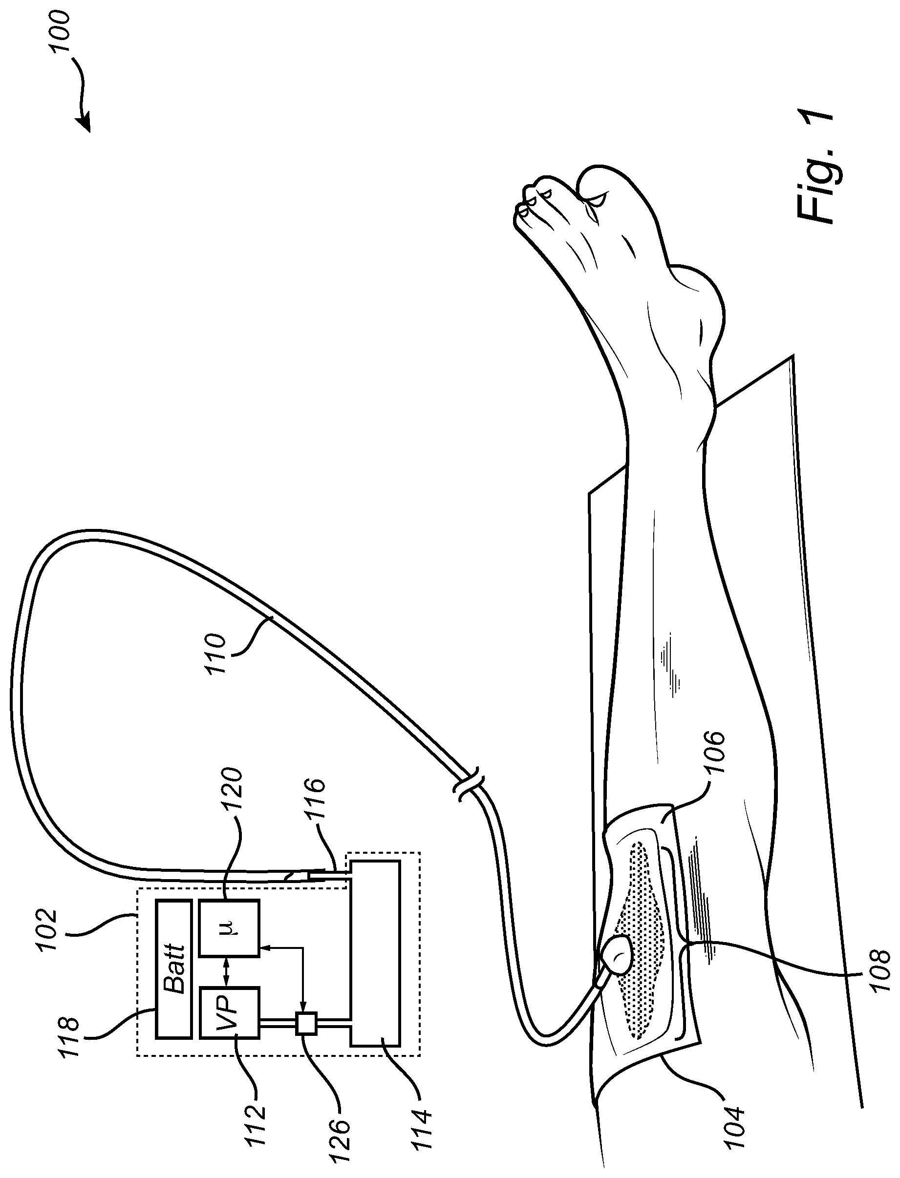 Patent US12496391 — Mobile negative pressure wound therapy device — Figure 1