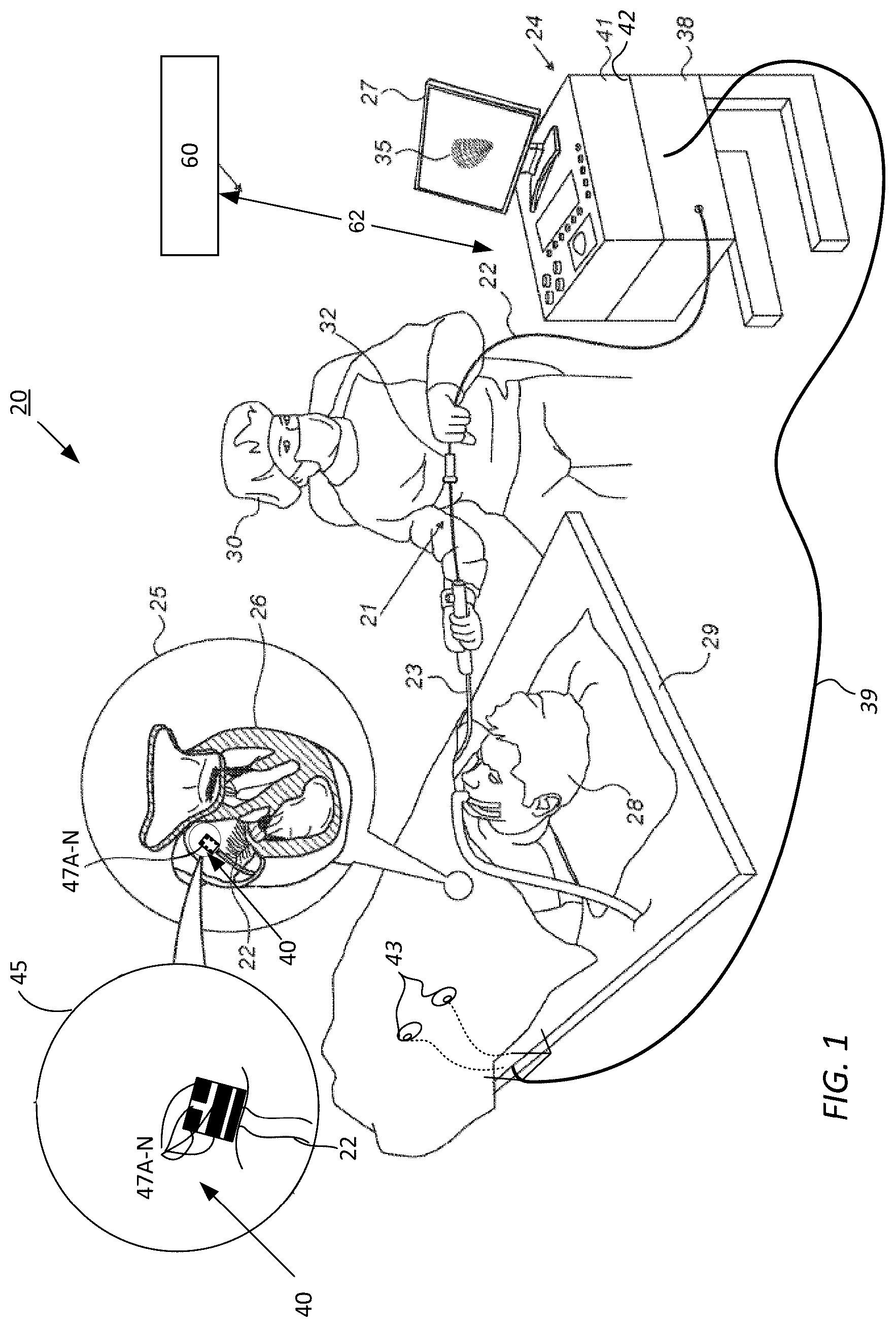 Patent US12496432 Figure 1 – Detection of catheter location, orientation, and movement direction
