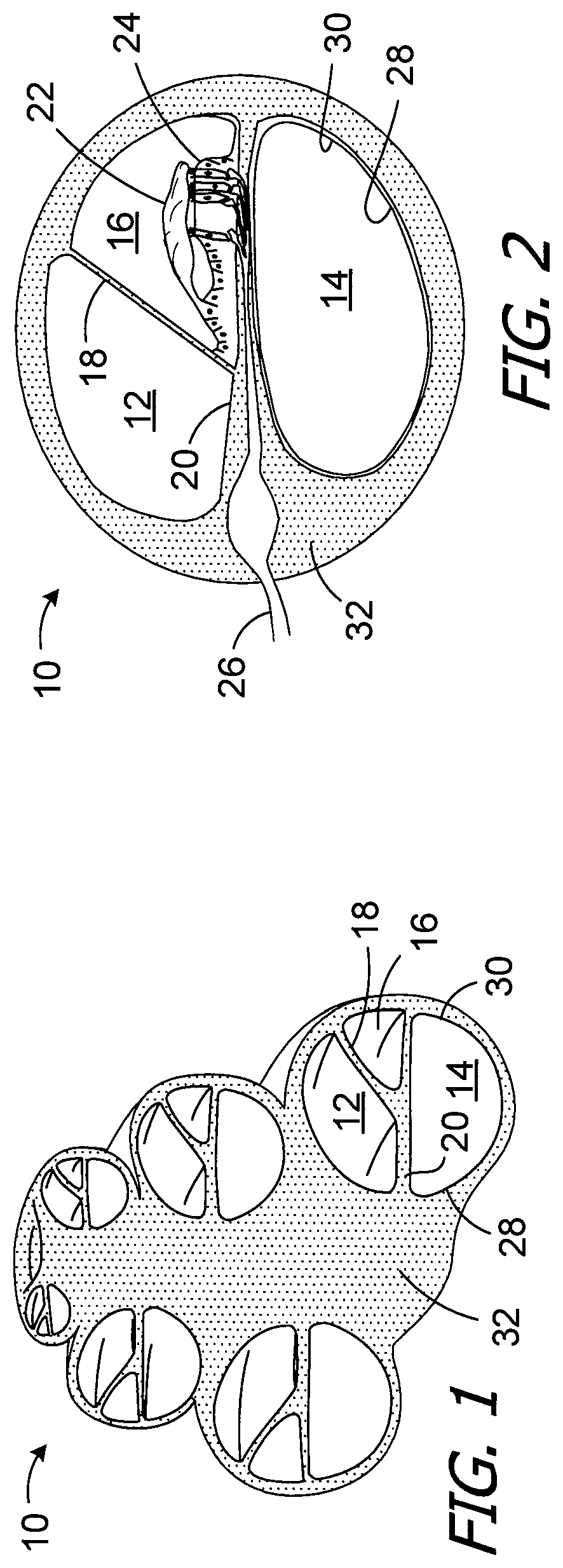 Patent US12496440 — Apparatus and methods for making cochlear implant electrode arrays — Figure 1
