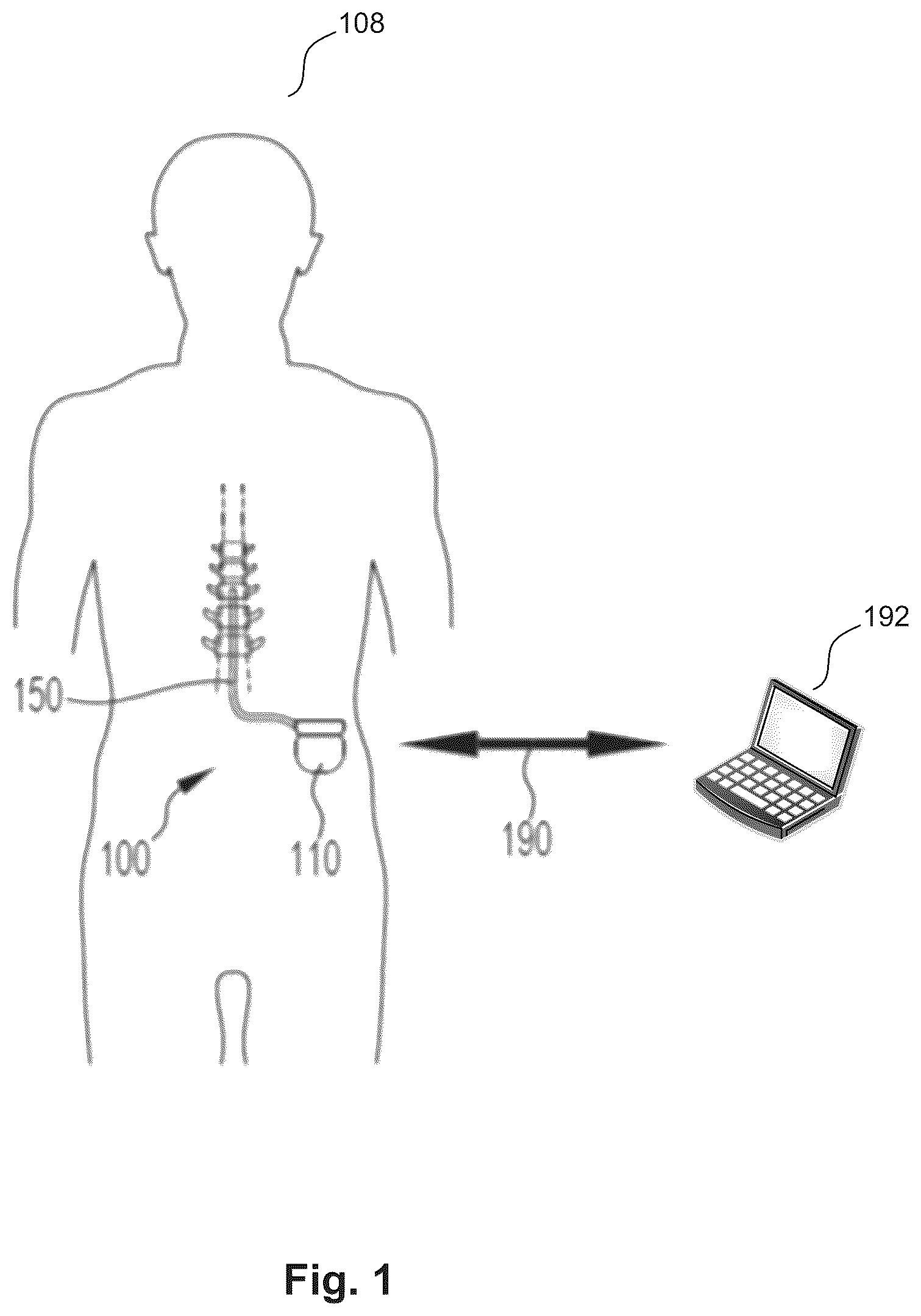 Patent US12496449 — Detection of neural responses to neurostimulation — Figure 1
